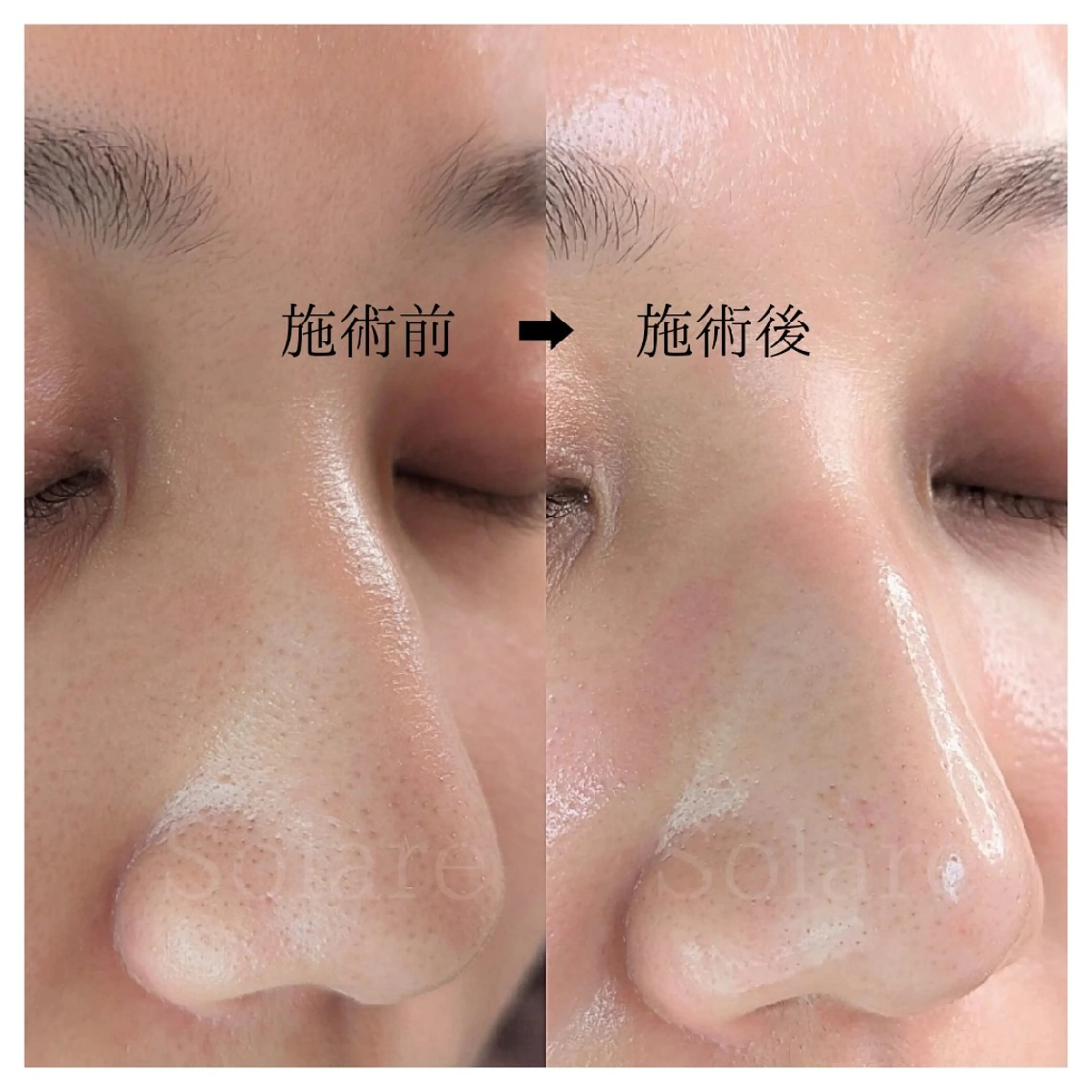  毛穴洗浄・まつ毛 の専門店 ソラーレのエステ・リラクイメージ