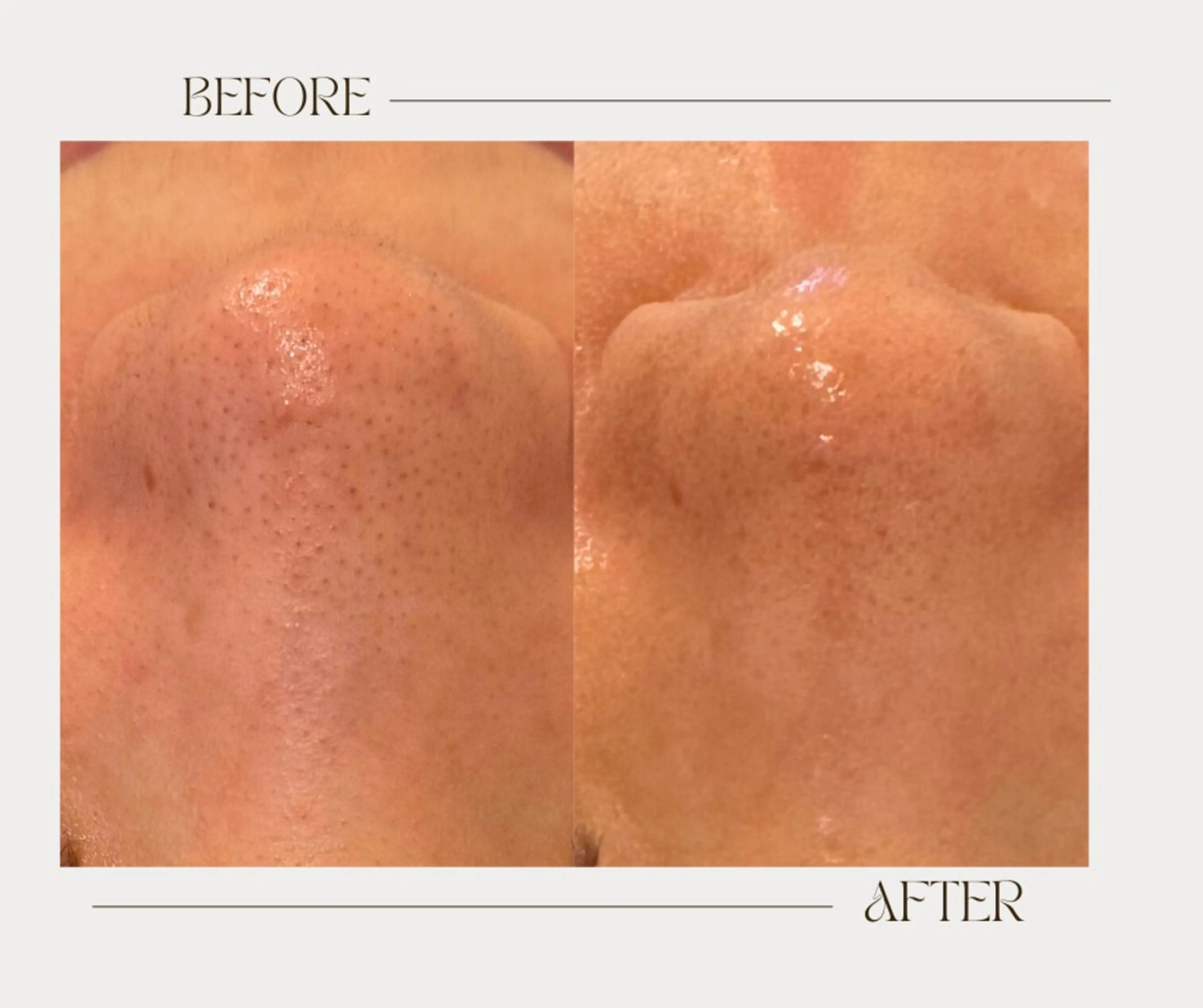 エステ 艶肌ワックス ALLY.のエステ・リラクイメージ