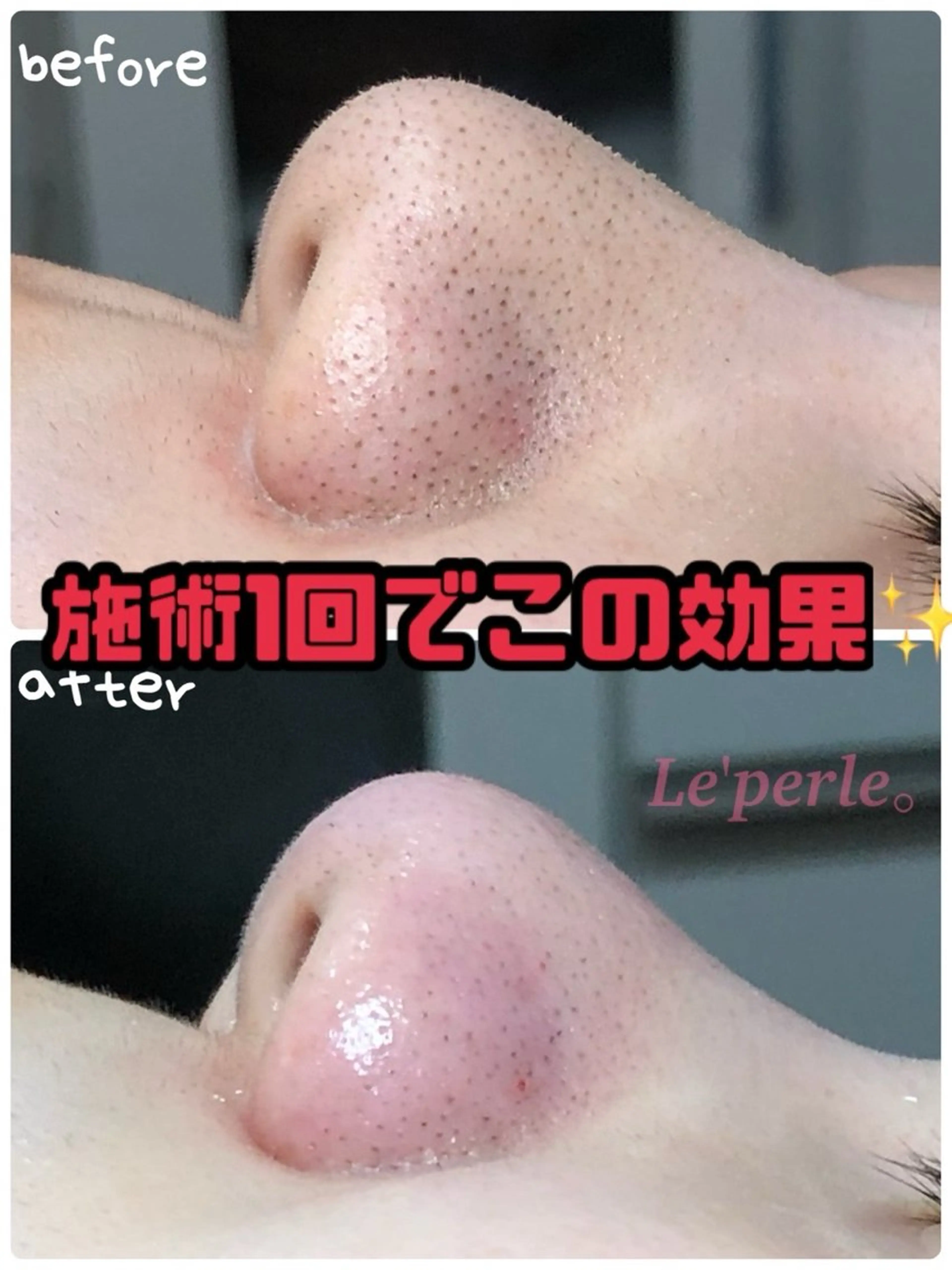 Le'perle｡ Kyokaのエステ・リラクイメージ