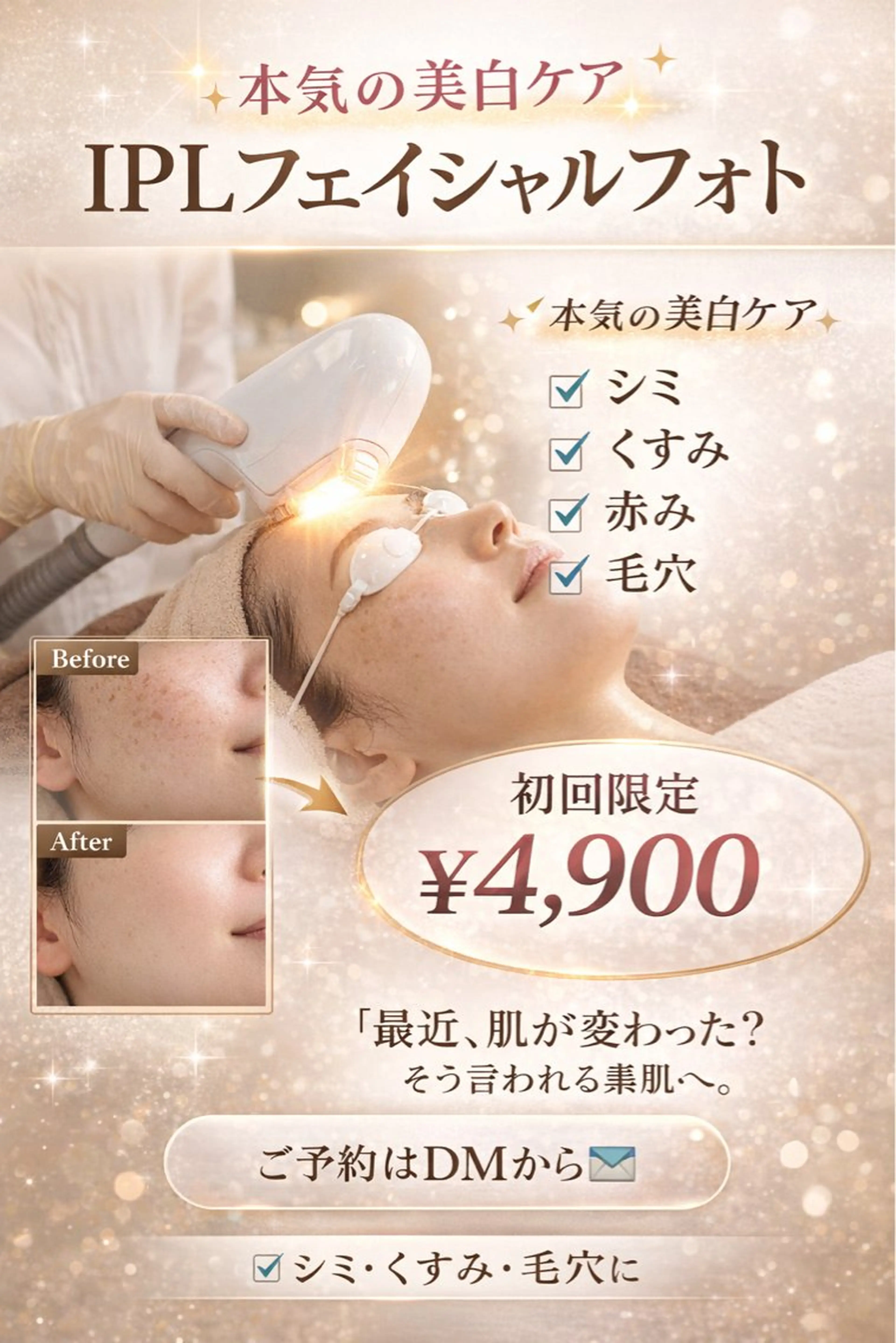 IPLフェイシャルの写真