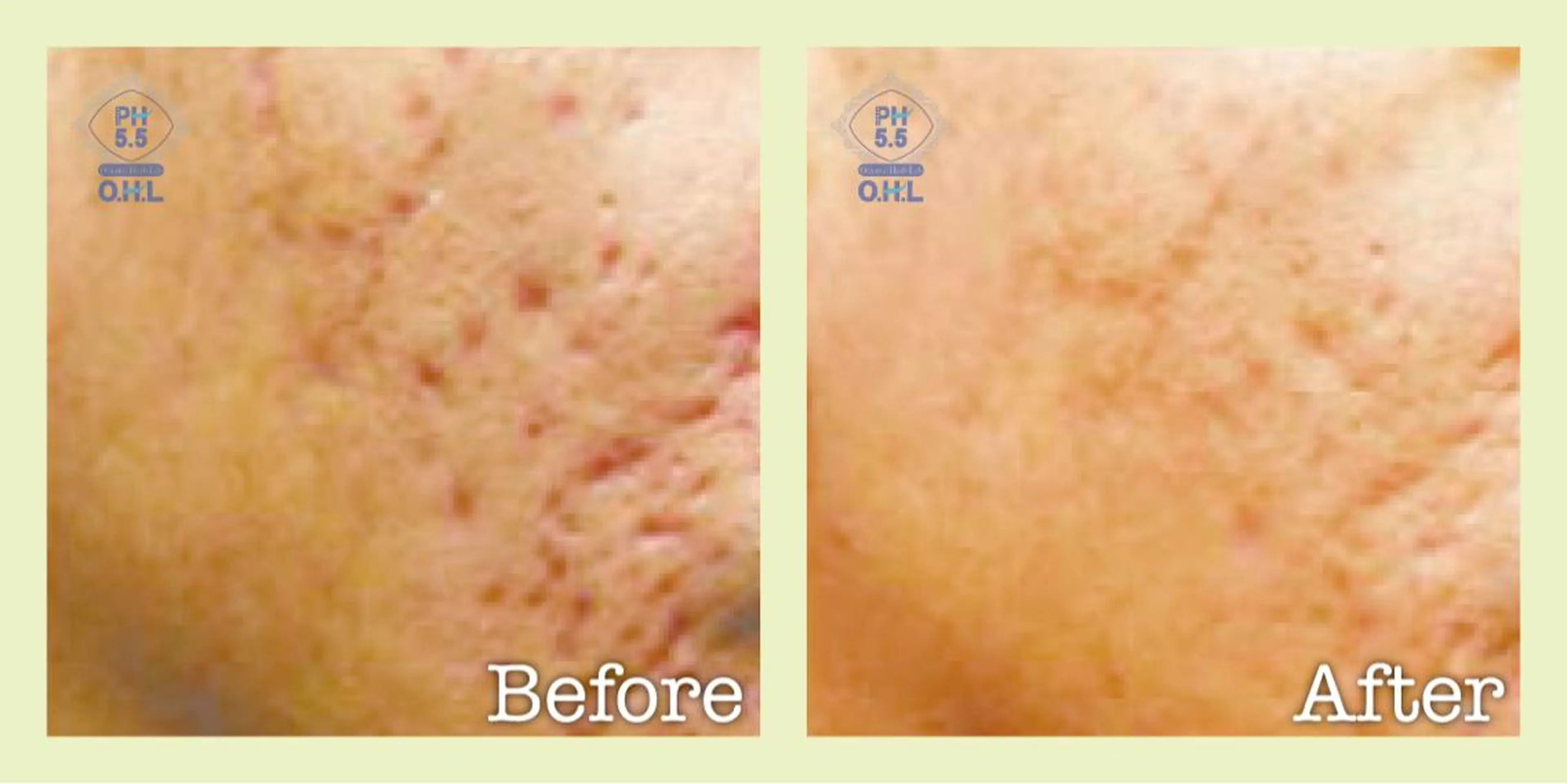 美肌脱毛フェイシャル サロンAMOのエステ・リラクイメージ