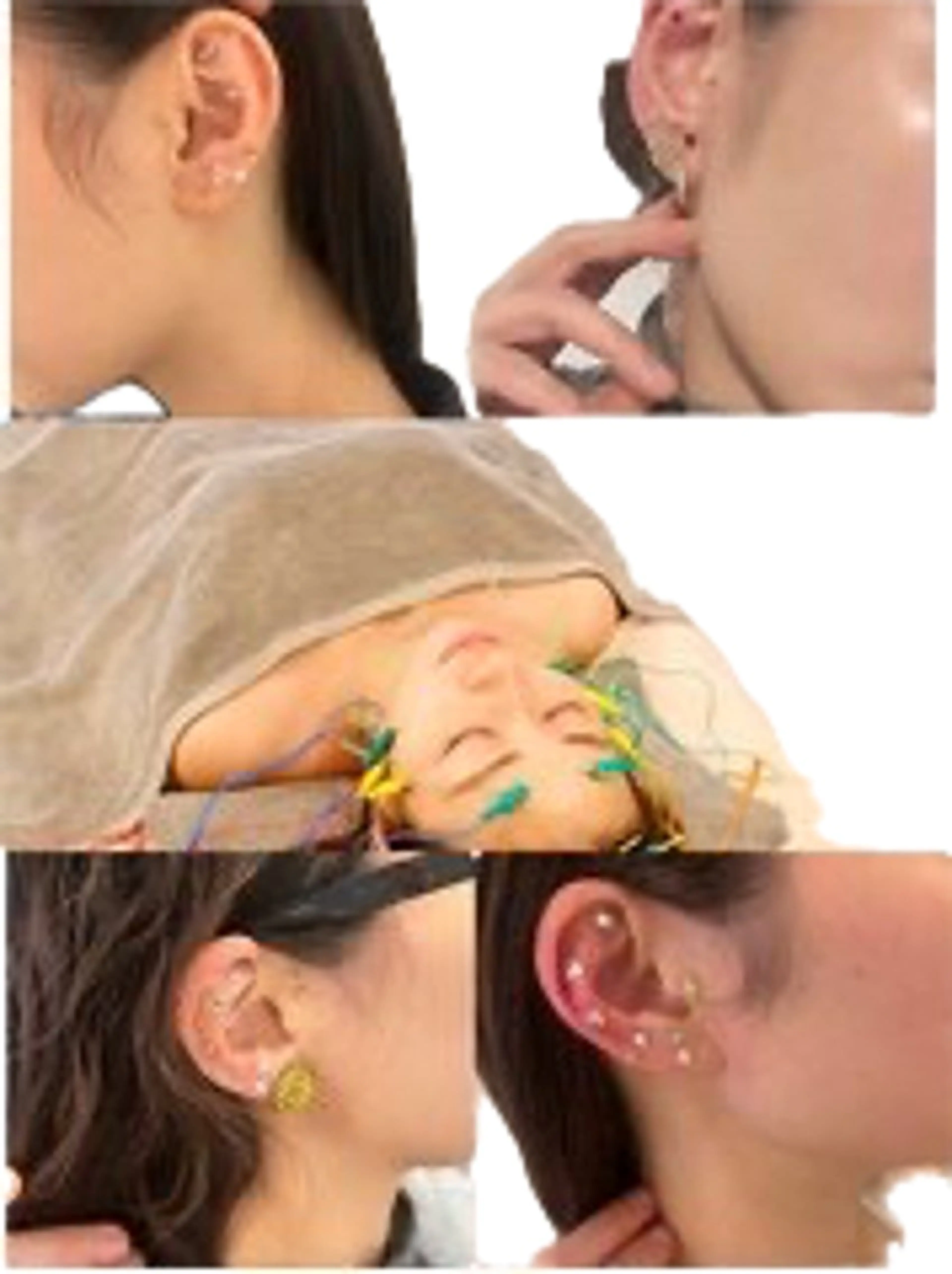 【耳ツボジュエリー👂💎＋電気美容鍼】お体の不調は耳ツボで！(学割500円OFF)の写真