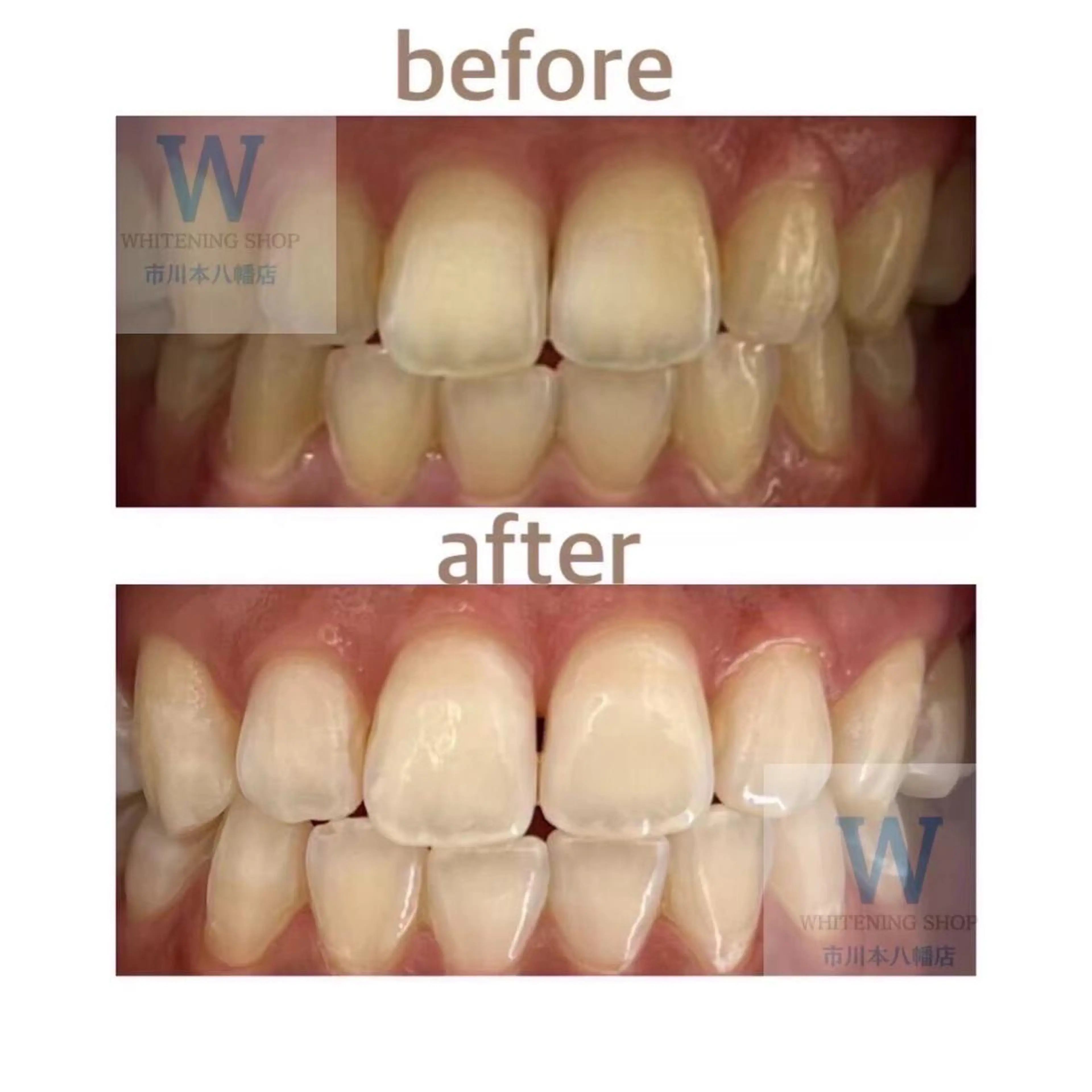 ホワイトニング ショップ本八幡店のエステ・リラクイメージ