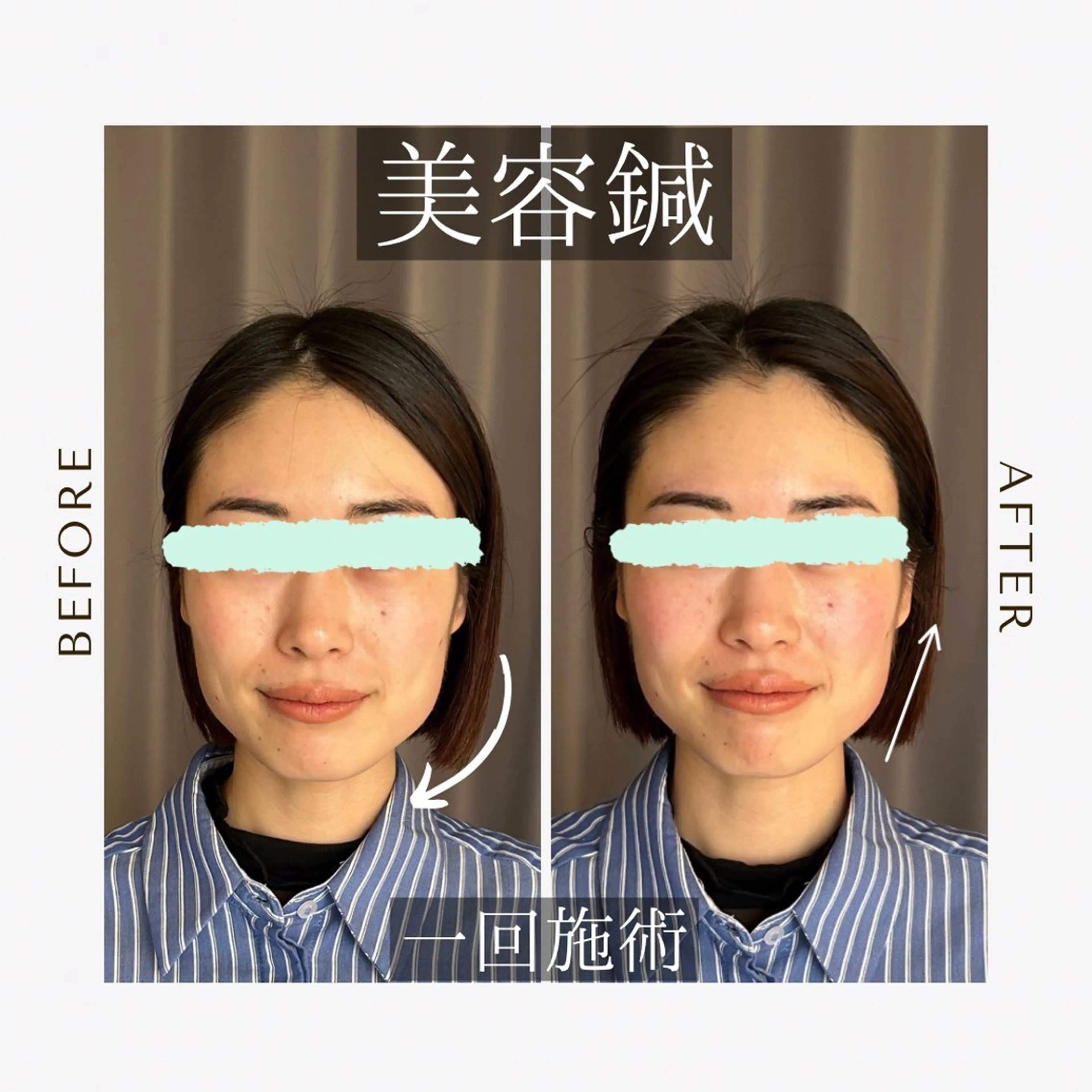 エステ リラク 《美肌･小顔》美容鍼 ＆マッサージ＊MEIのエステ・リラクイメージ