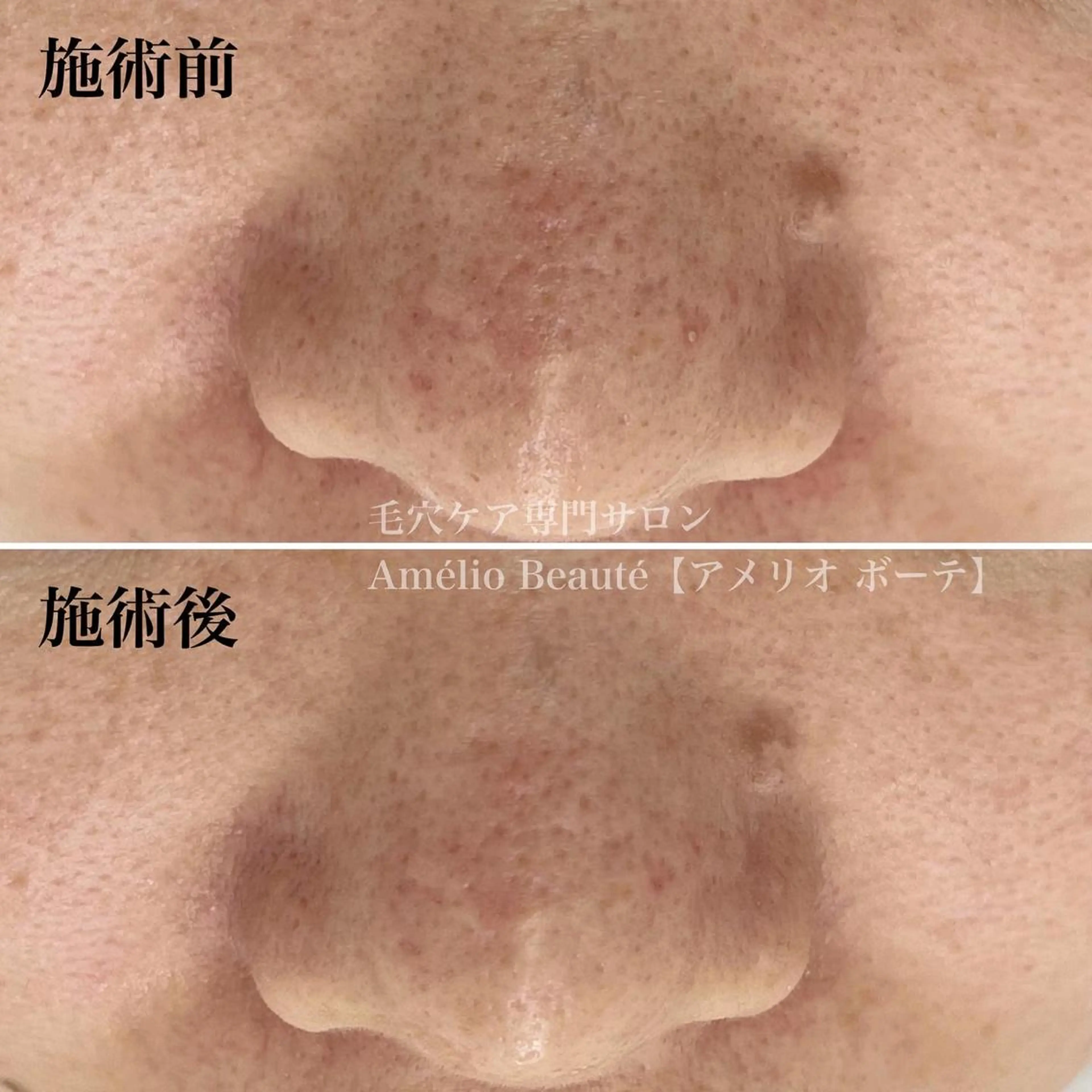 毛穴ケア専門サロン アメリオボーテのその他イメージ