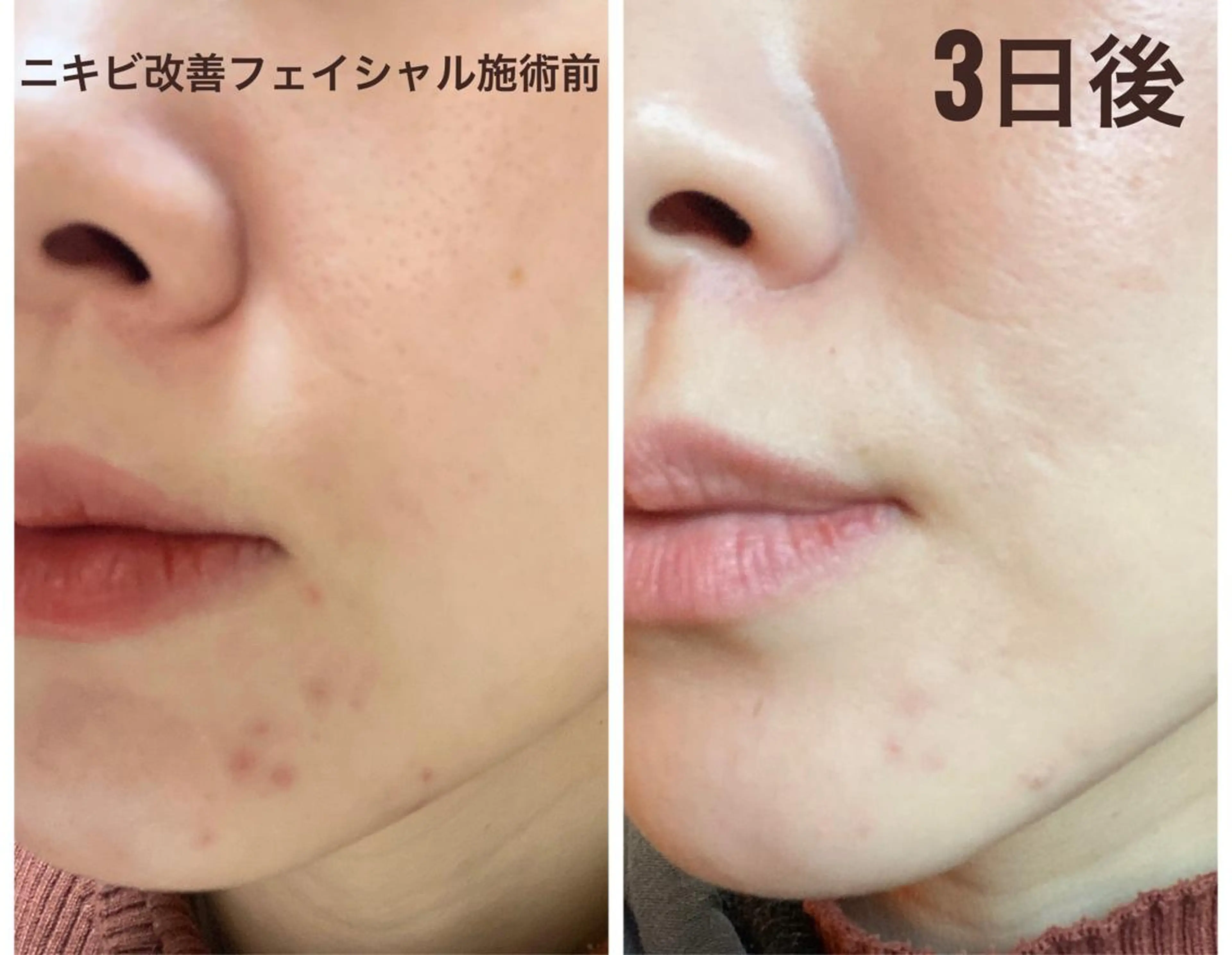 エステ COCO beautyサロンのエステ・リラクイメージ