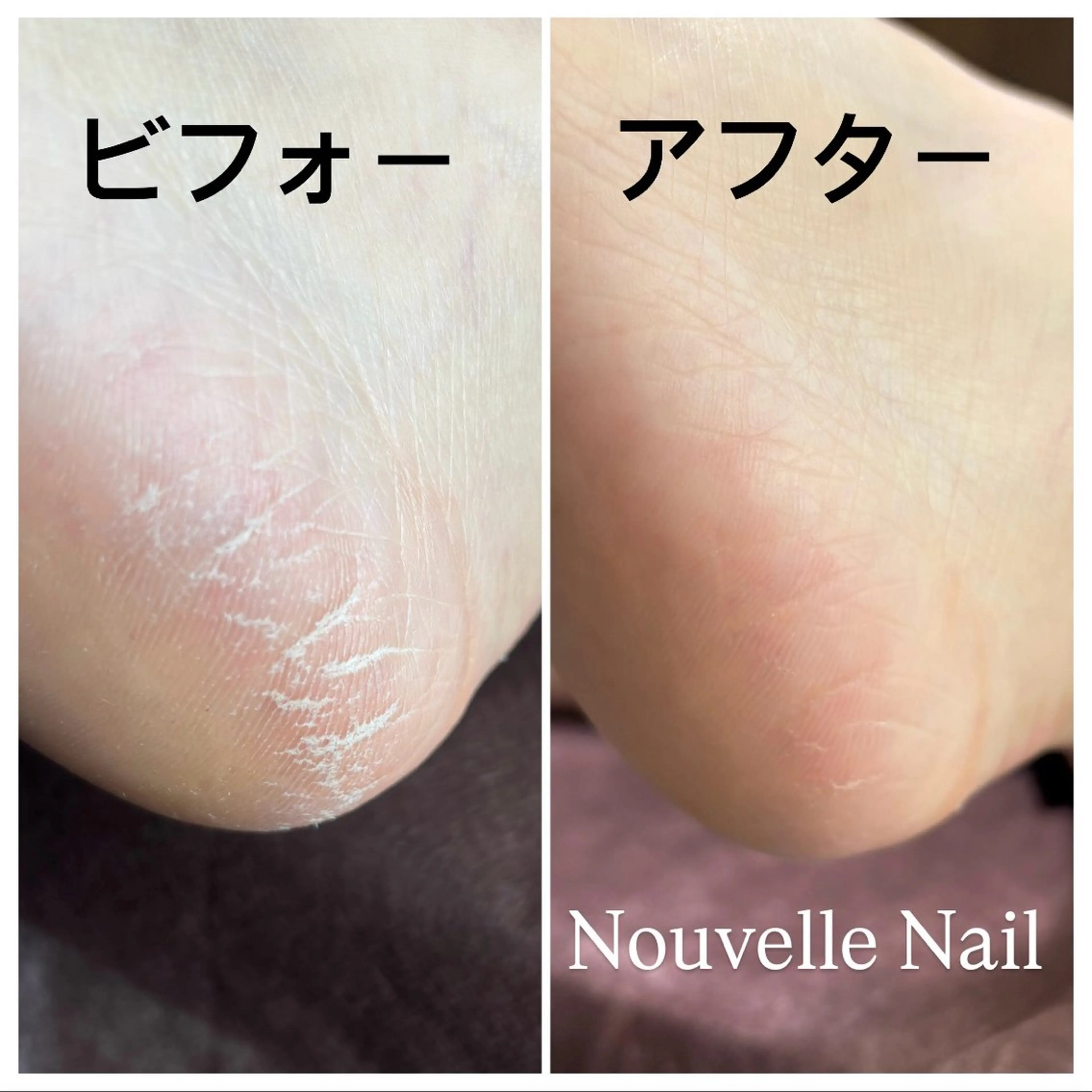 ネイル 氷ネイル・うるうるネイル Nouvelle Nailのネイルデザイン