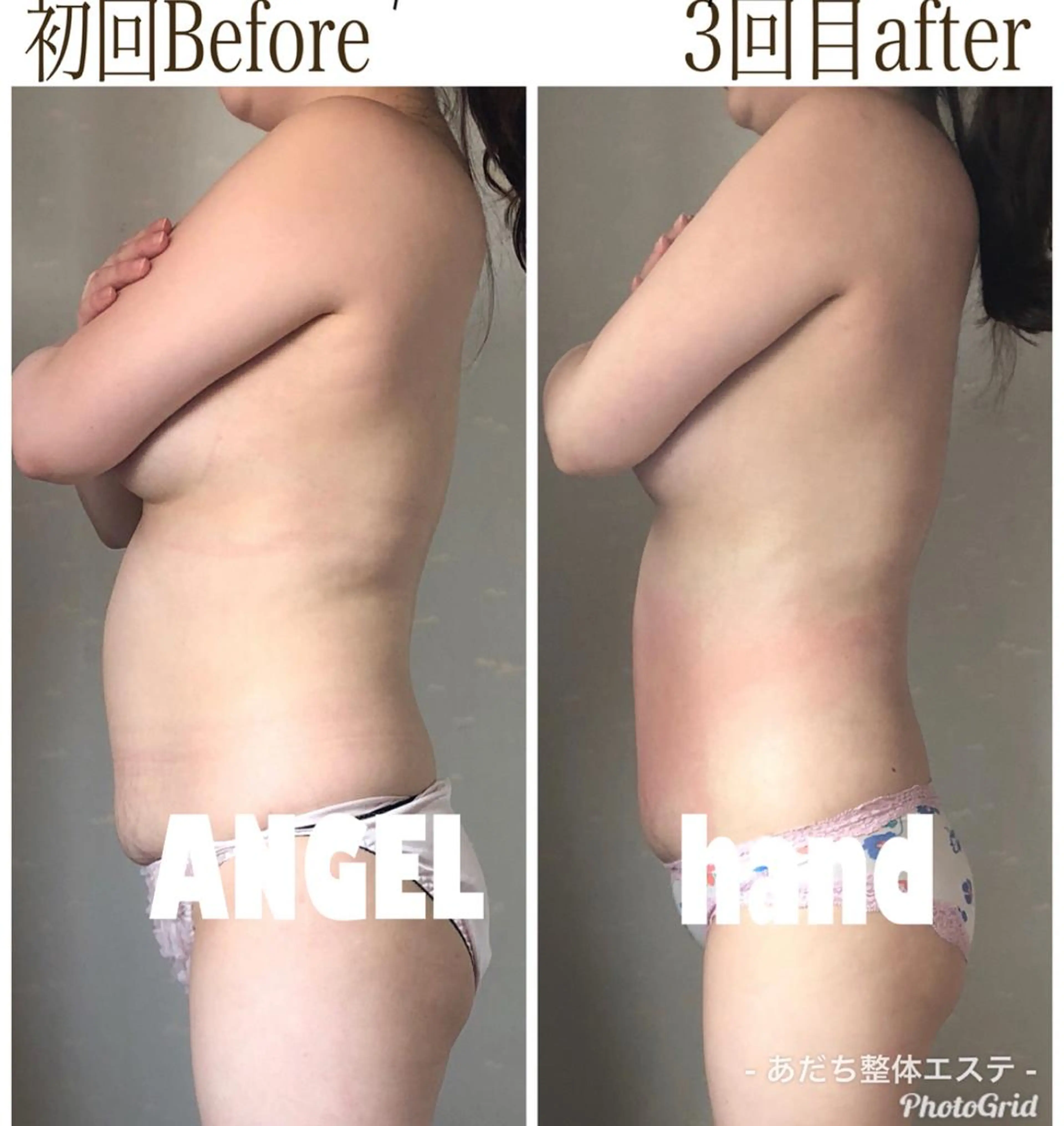 セラピーグレード代謝サポートオイル使用全身痩身リンパの写真