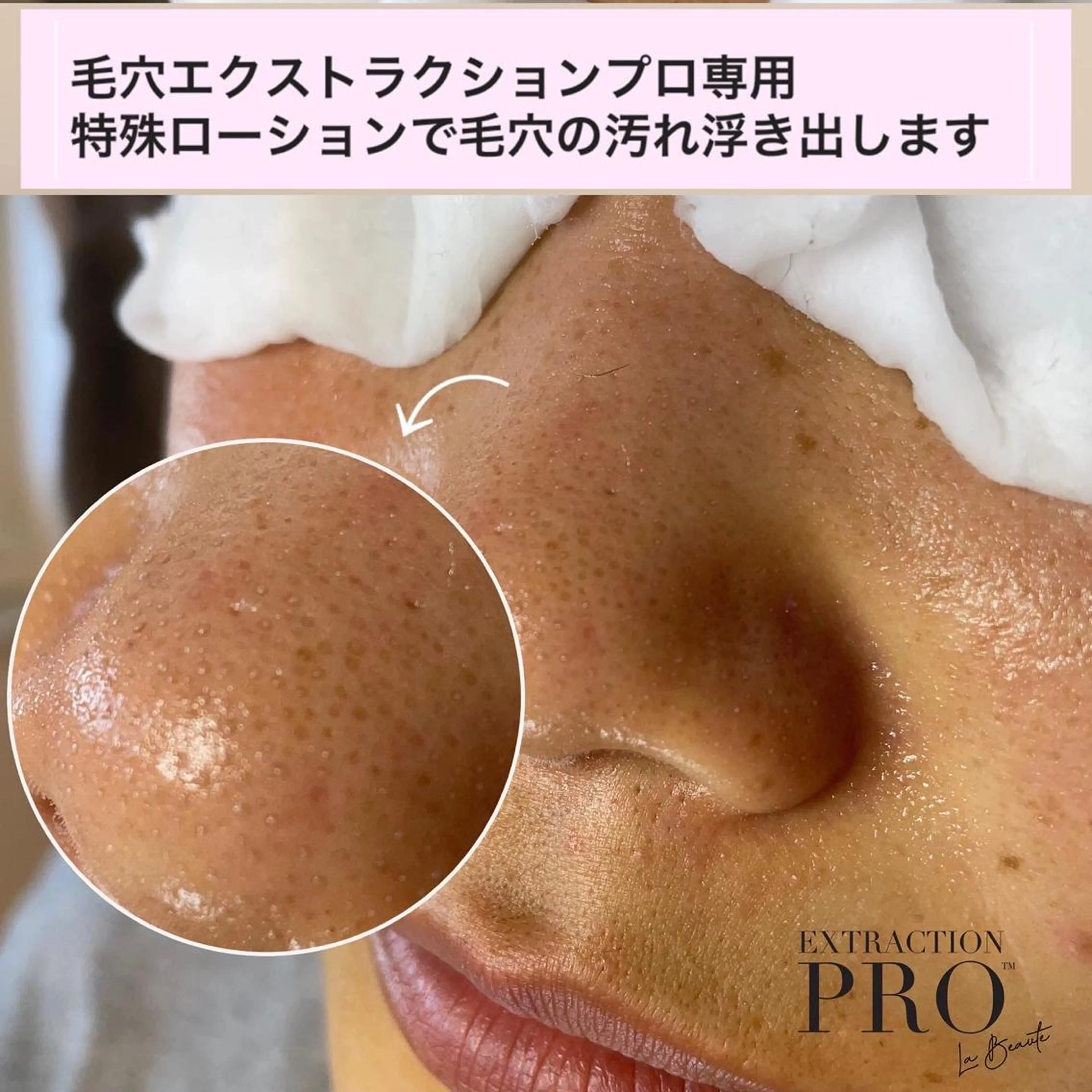 メンズ Mignon + Natsukiのマツエク・マツパデザイン