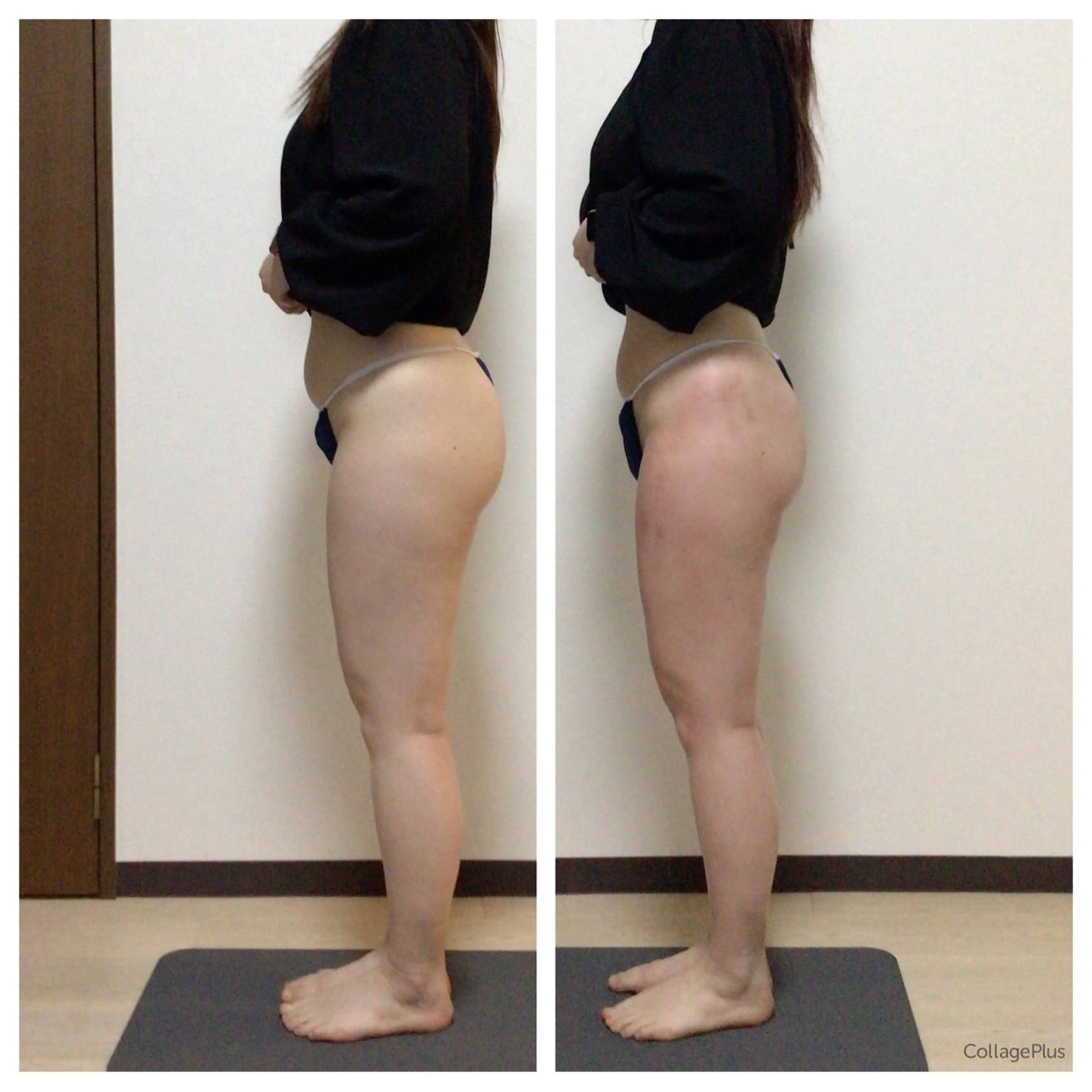 下半身 セルライトクラッシュ　　25分スライドカッピング　モニターの写真