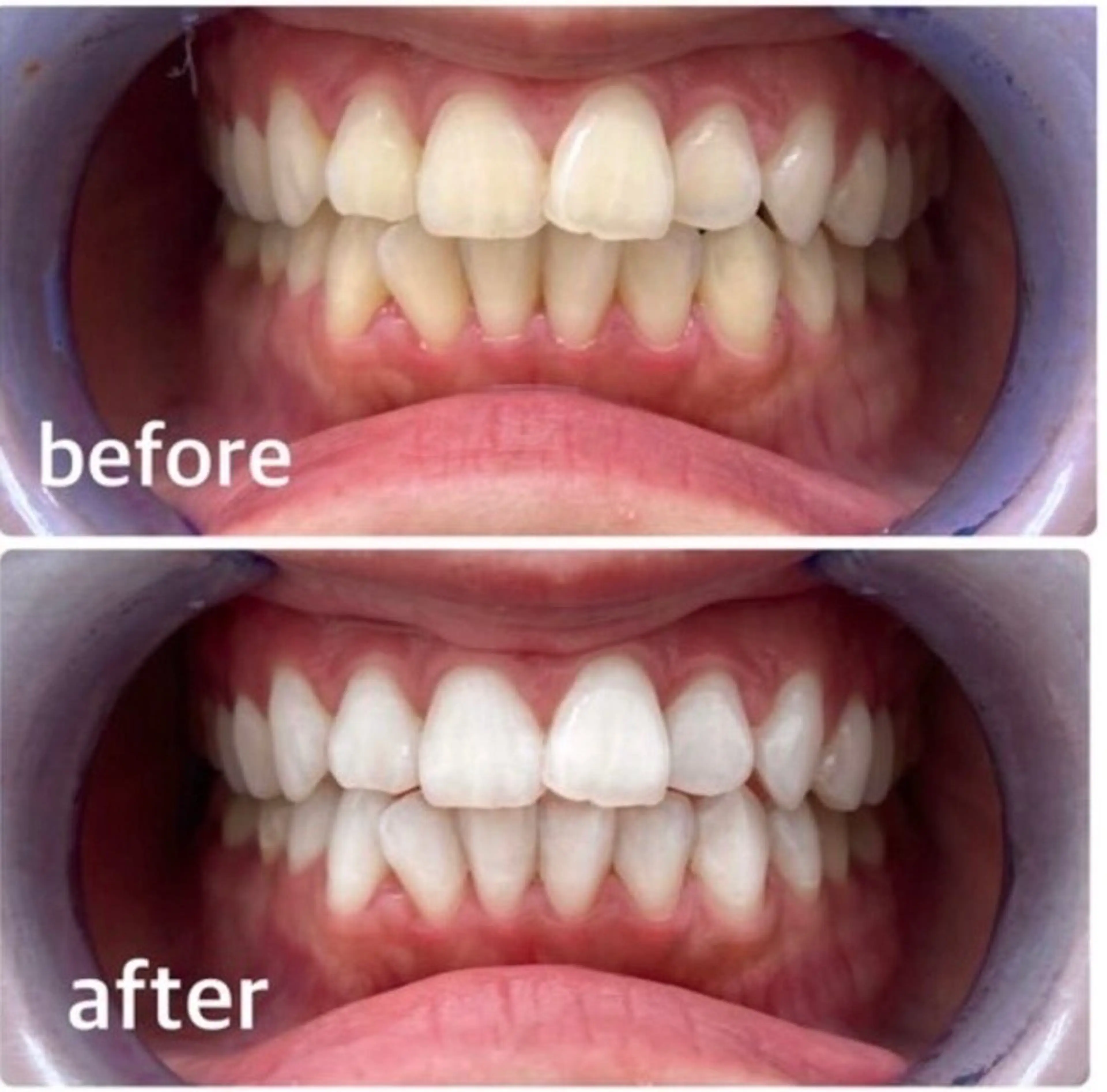 エクシアホワイト 立川南口のエステ・リラクイメージ