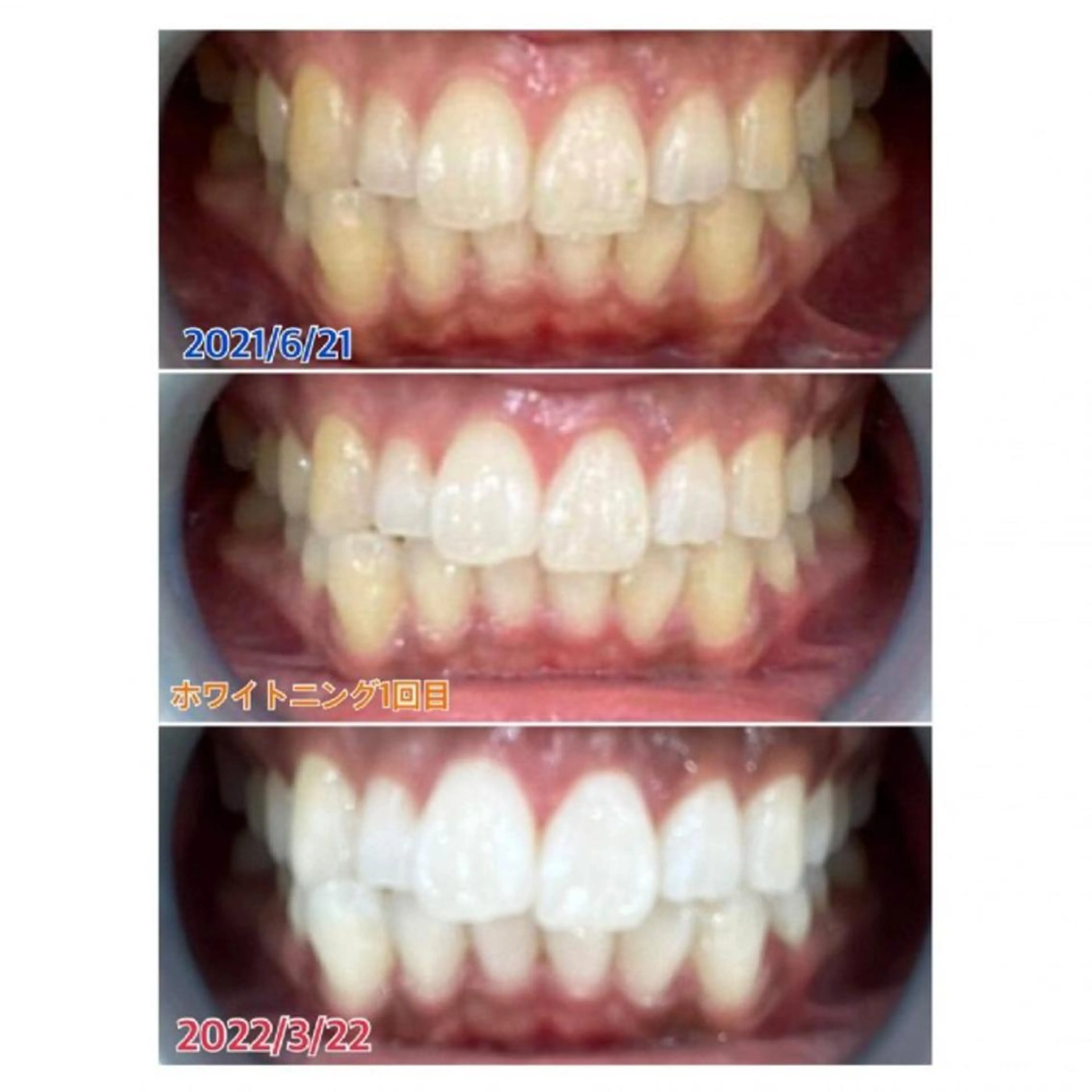 Ｍ渋谷 ホワイトニングのエステ・リラクイメージ