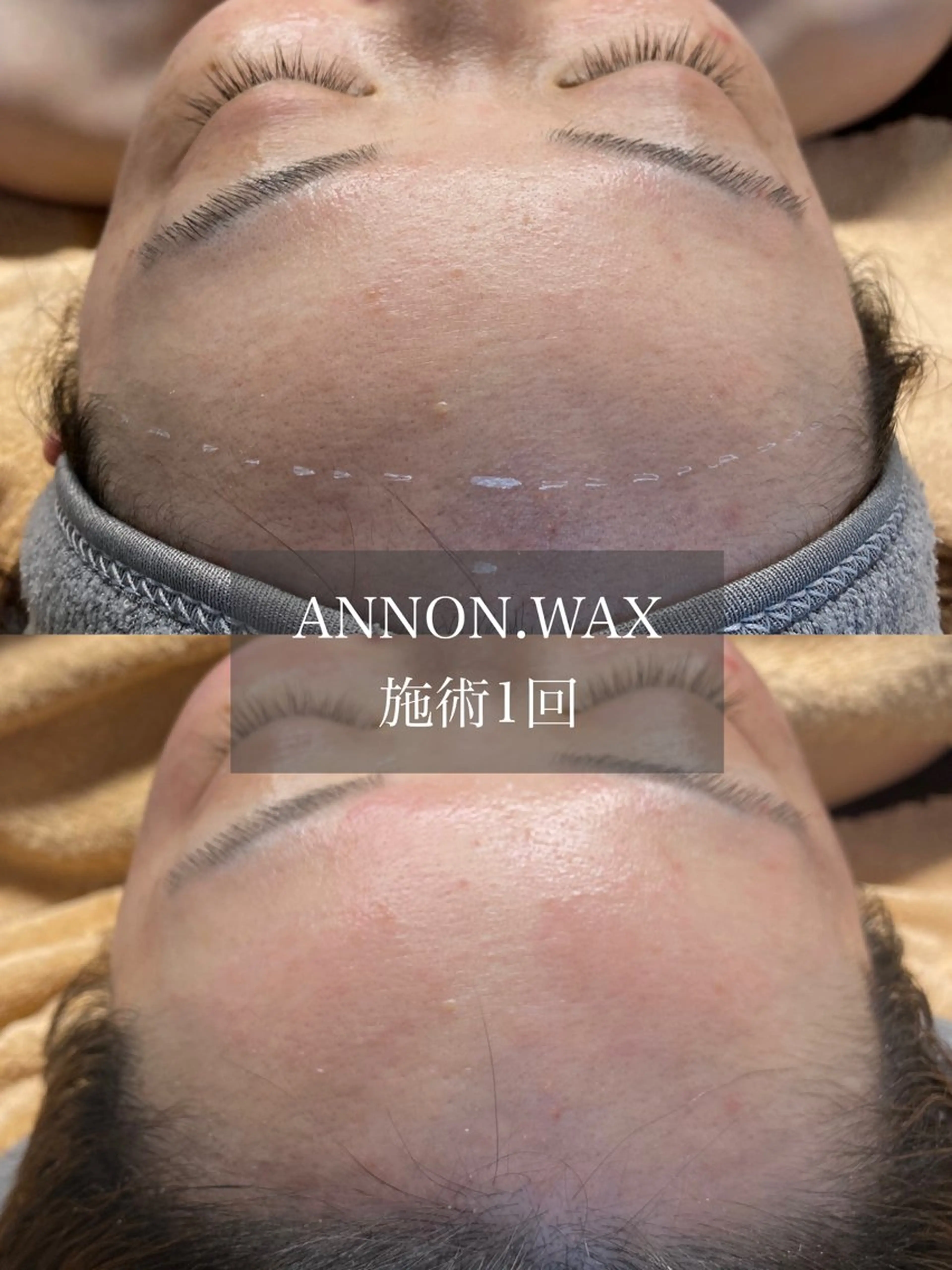 エステ 肌質改善ワックス専門 yukiのエステ・リラクイメージ