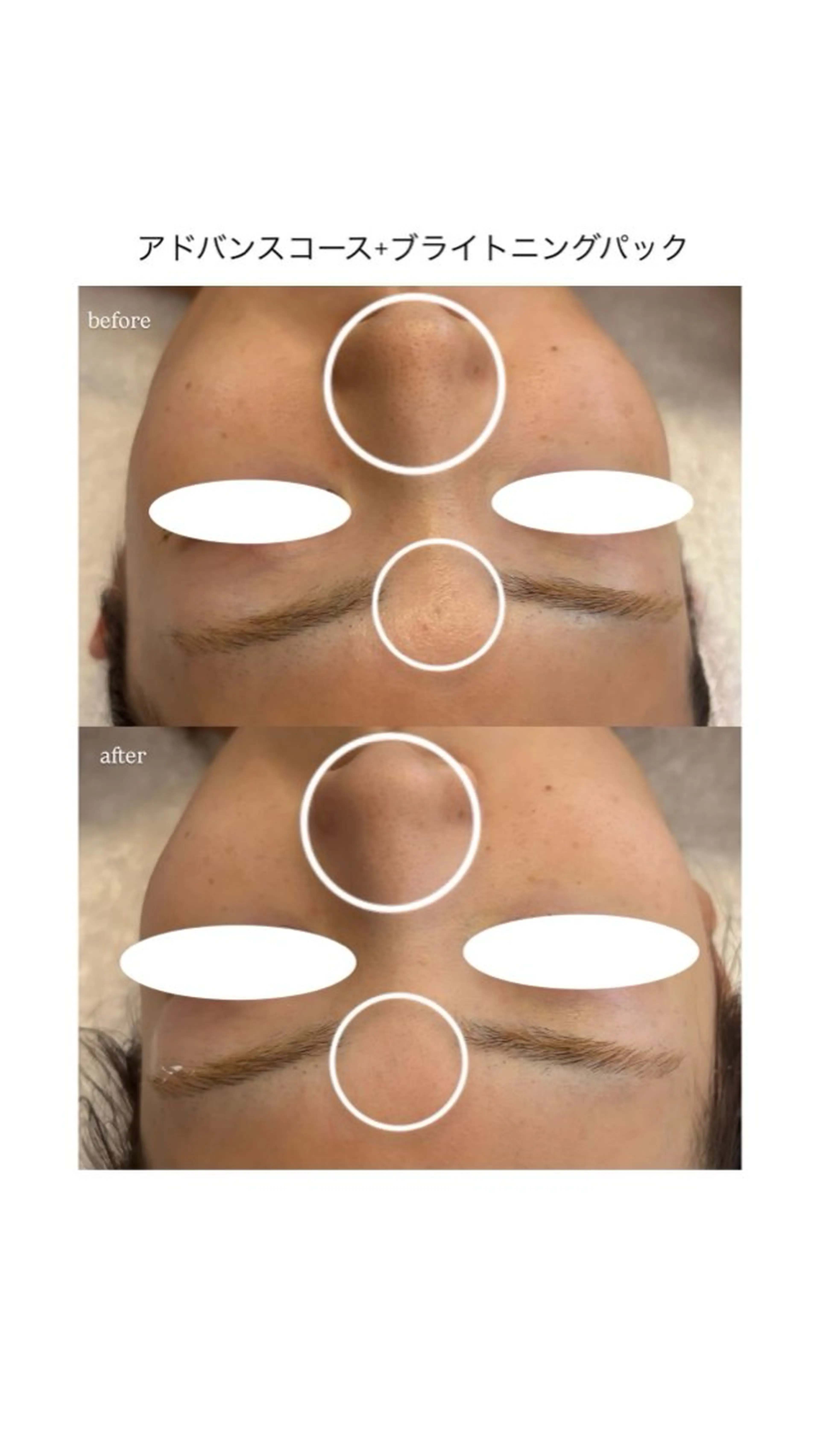 エステ メナードフェイシャルサロン 熊本インター西店所属・フェイシャルエステ 🎀　naoのエステ・リラクイメージ