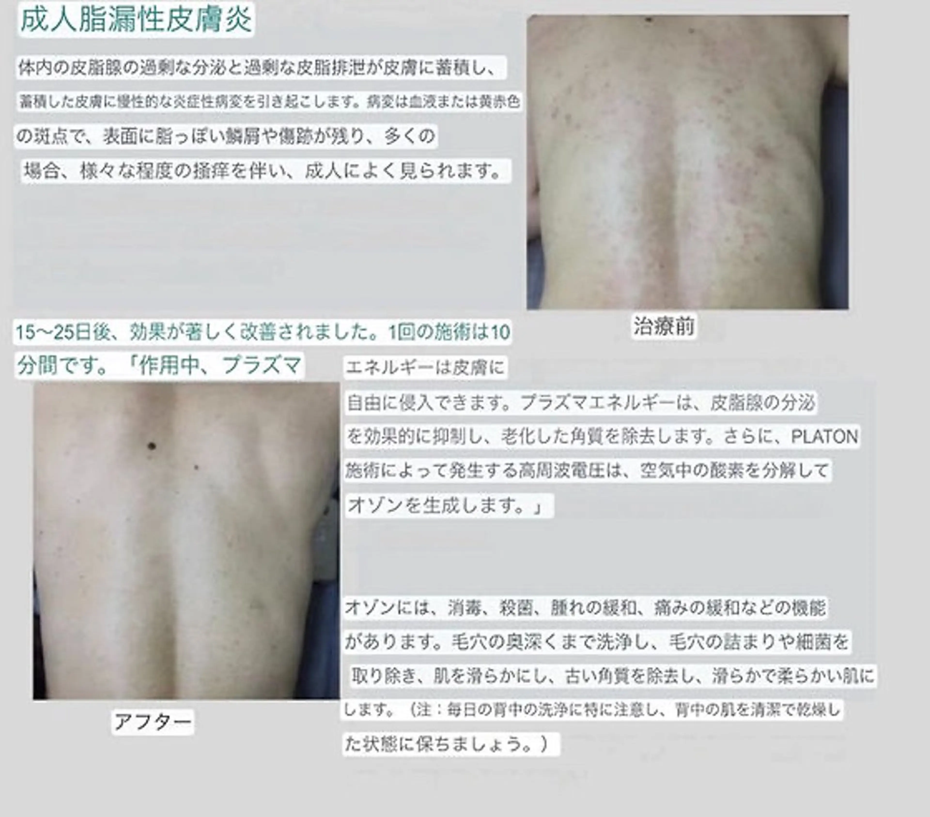 メンズ エステ セルフエステ ALL in ONE所属・1組貸切 セルフエステのエステ・リラクイメージ