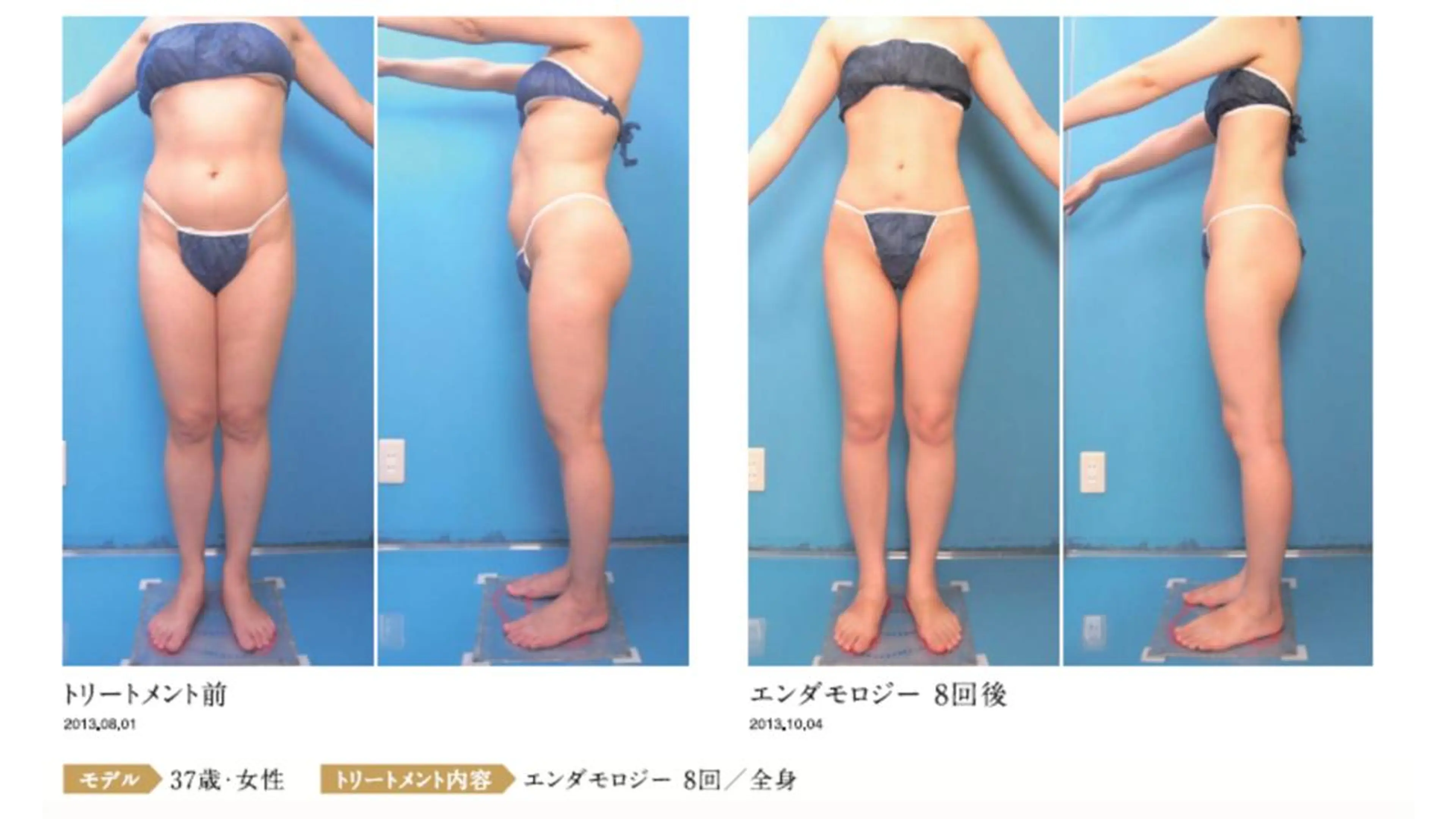 オレンジバナナ 新潟店のエステ・リラクイメージ