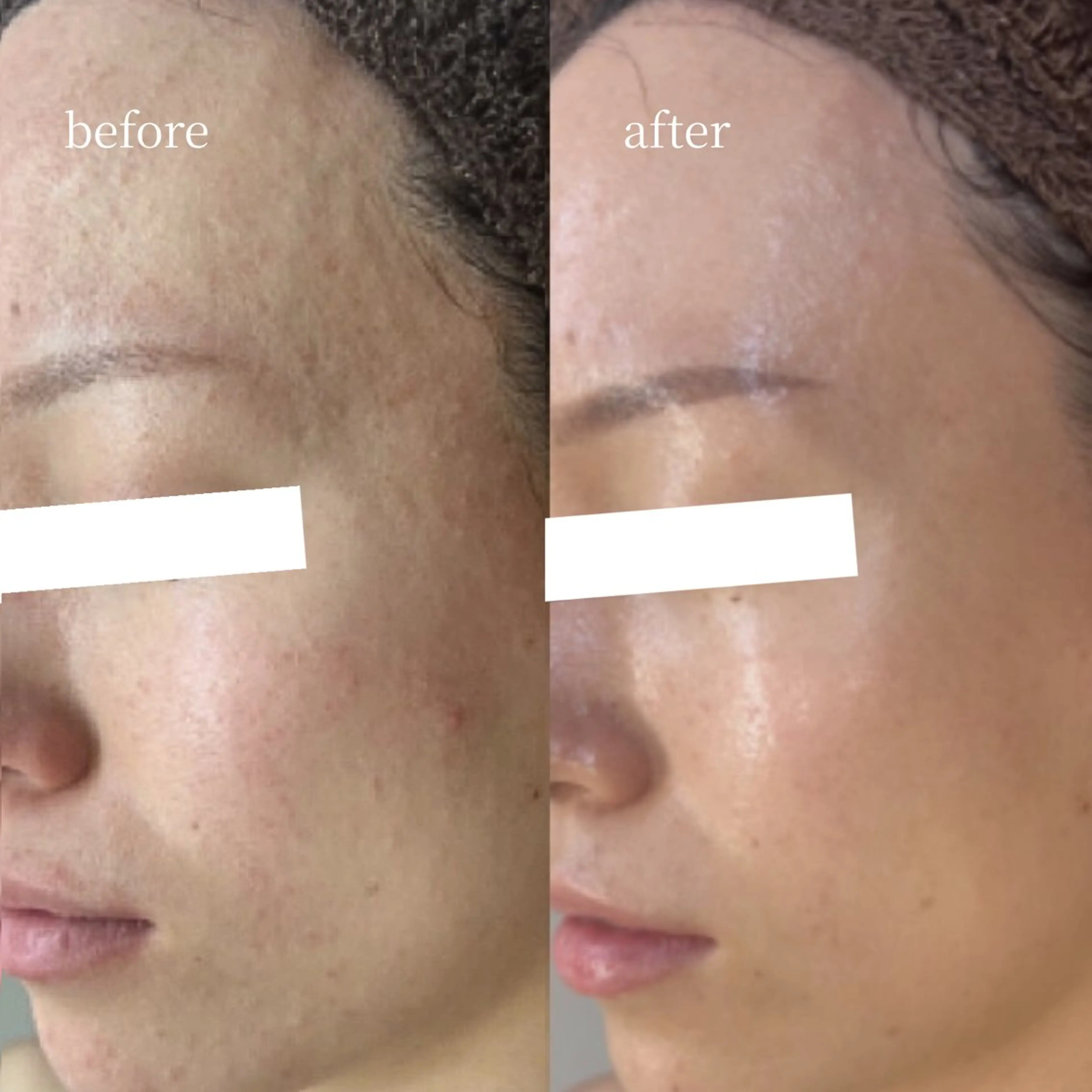 エステ 韓国肌管理・肌質改善 EARNEST心斎橋のエステ・リラクイメージ