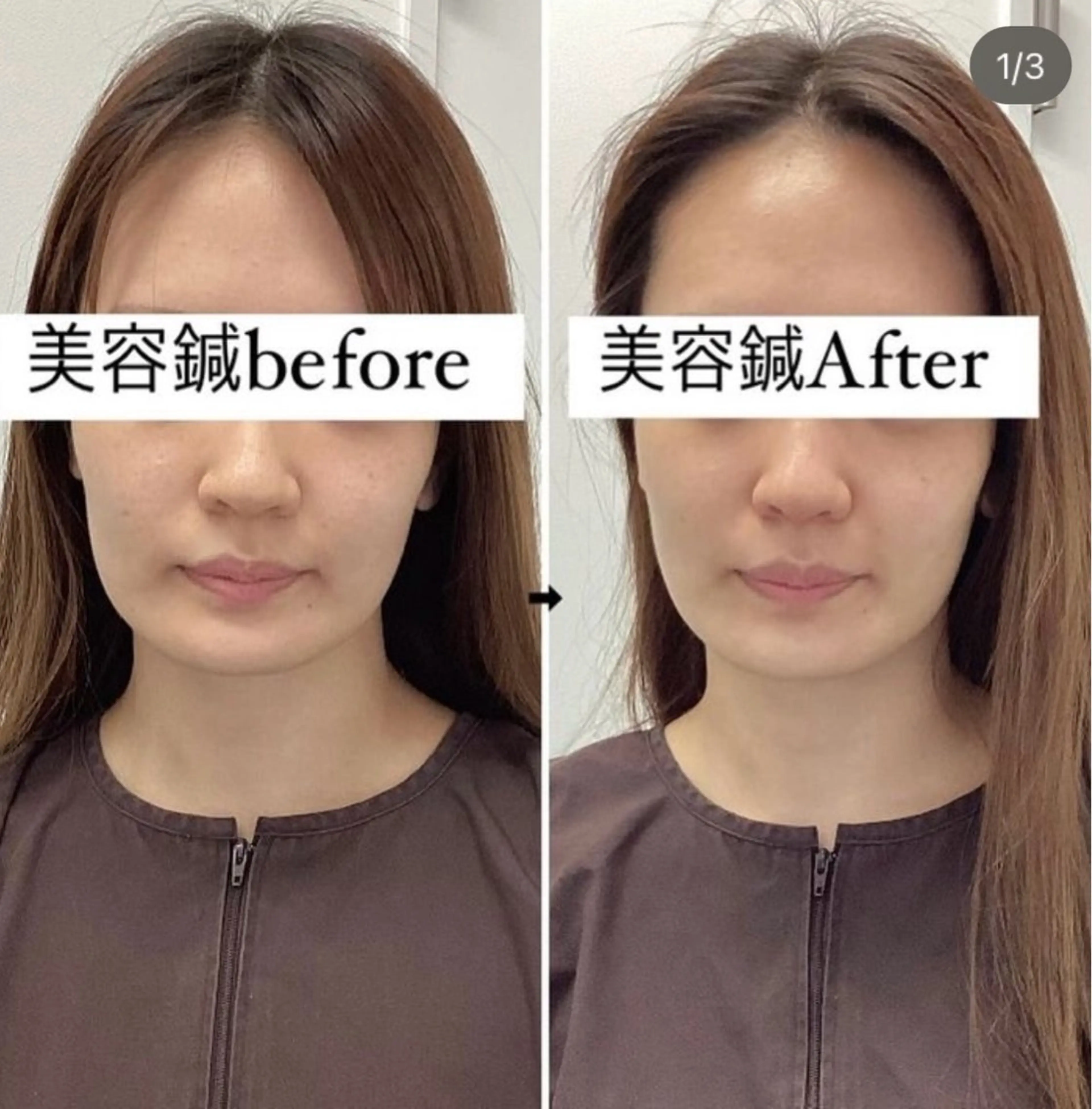 エステ リラク 美容鍼灸×小顔整体♡ ハリサロンドオフ堺東のその他イメージ