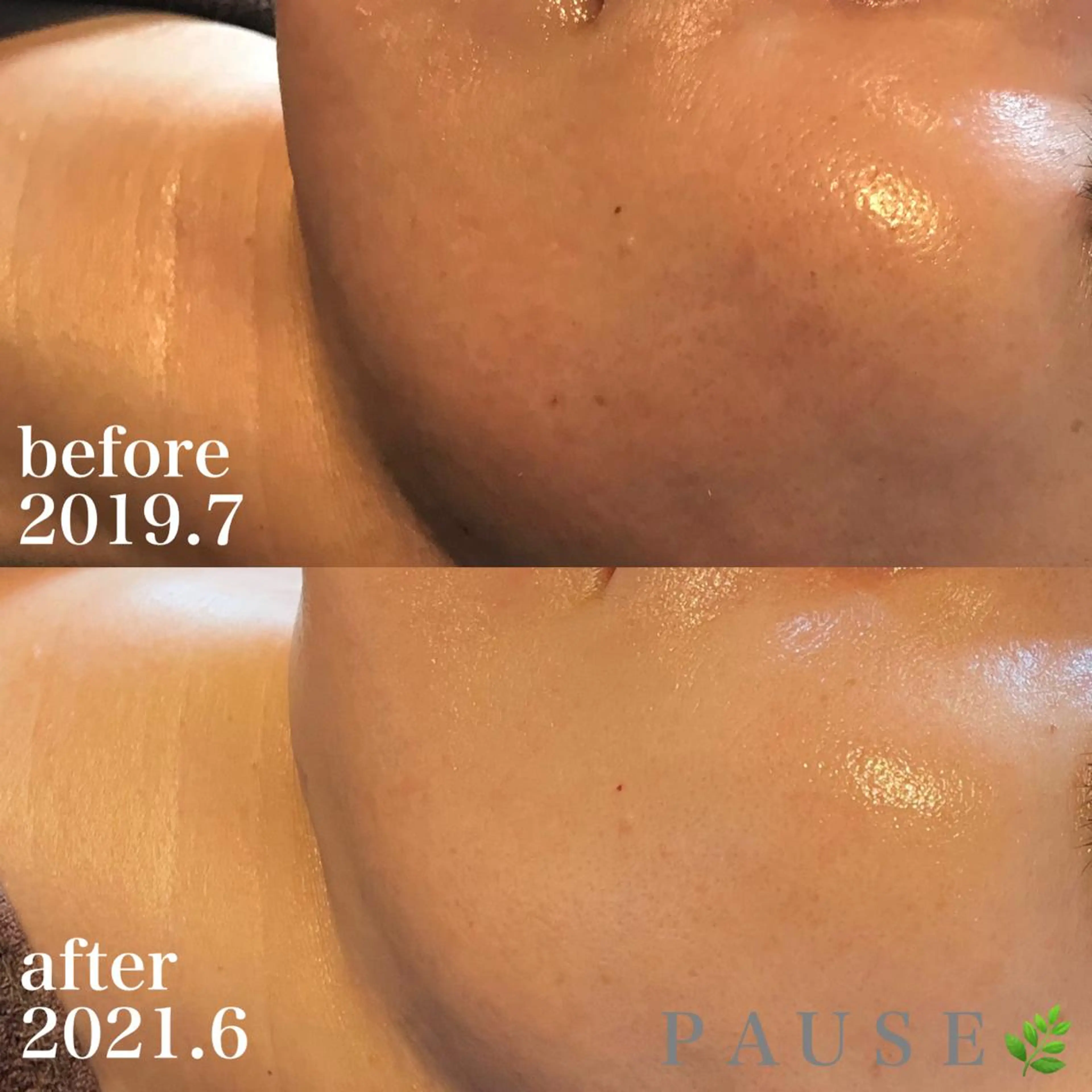 エステ 浜野 恵美のエステ・リラクイメージ