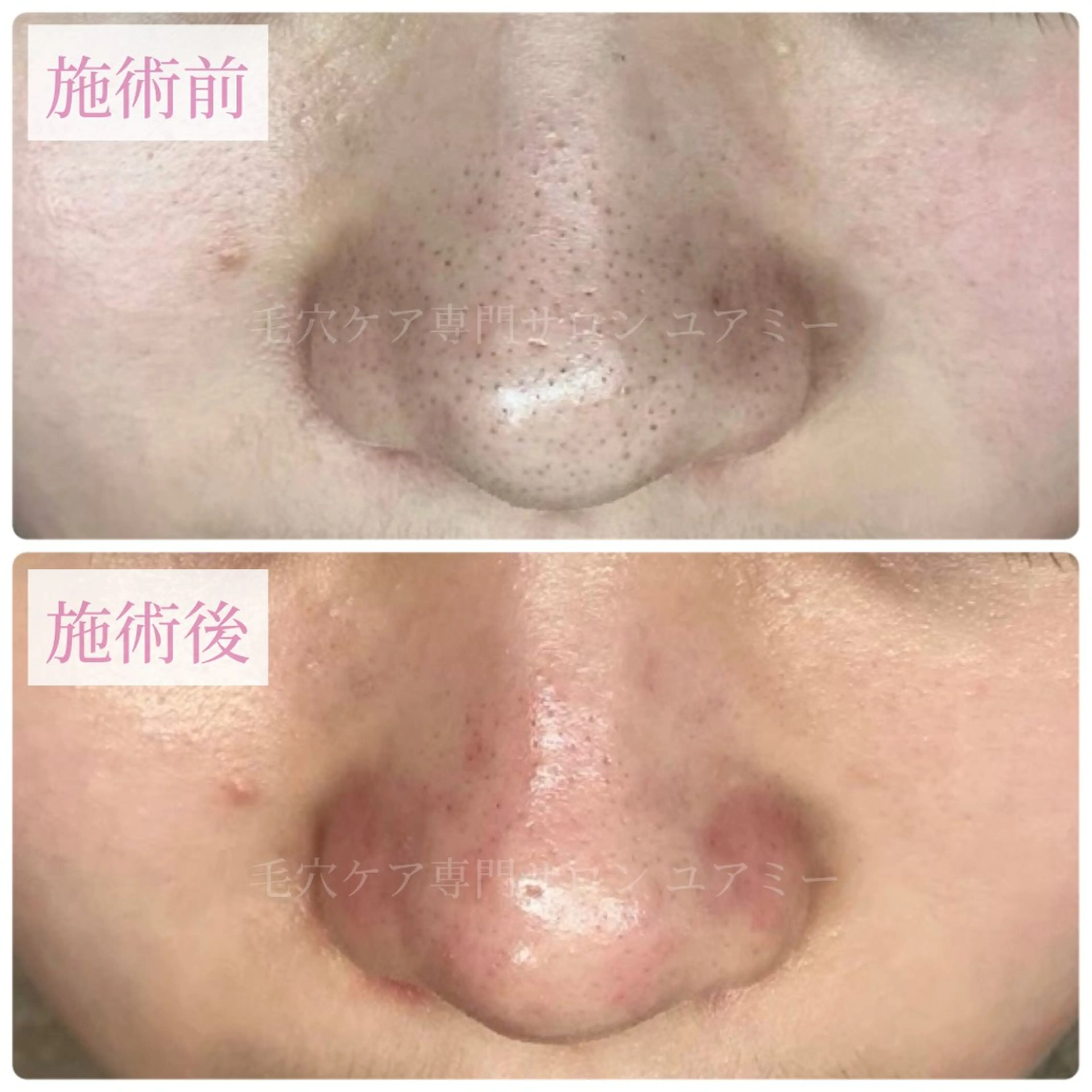 毛穴肌質ケアサロン Yourmeユアミーのエステ・リラクイメージ