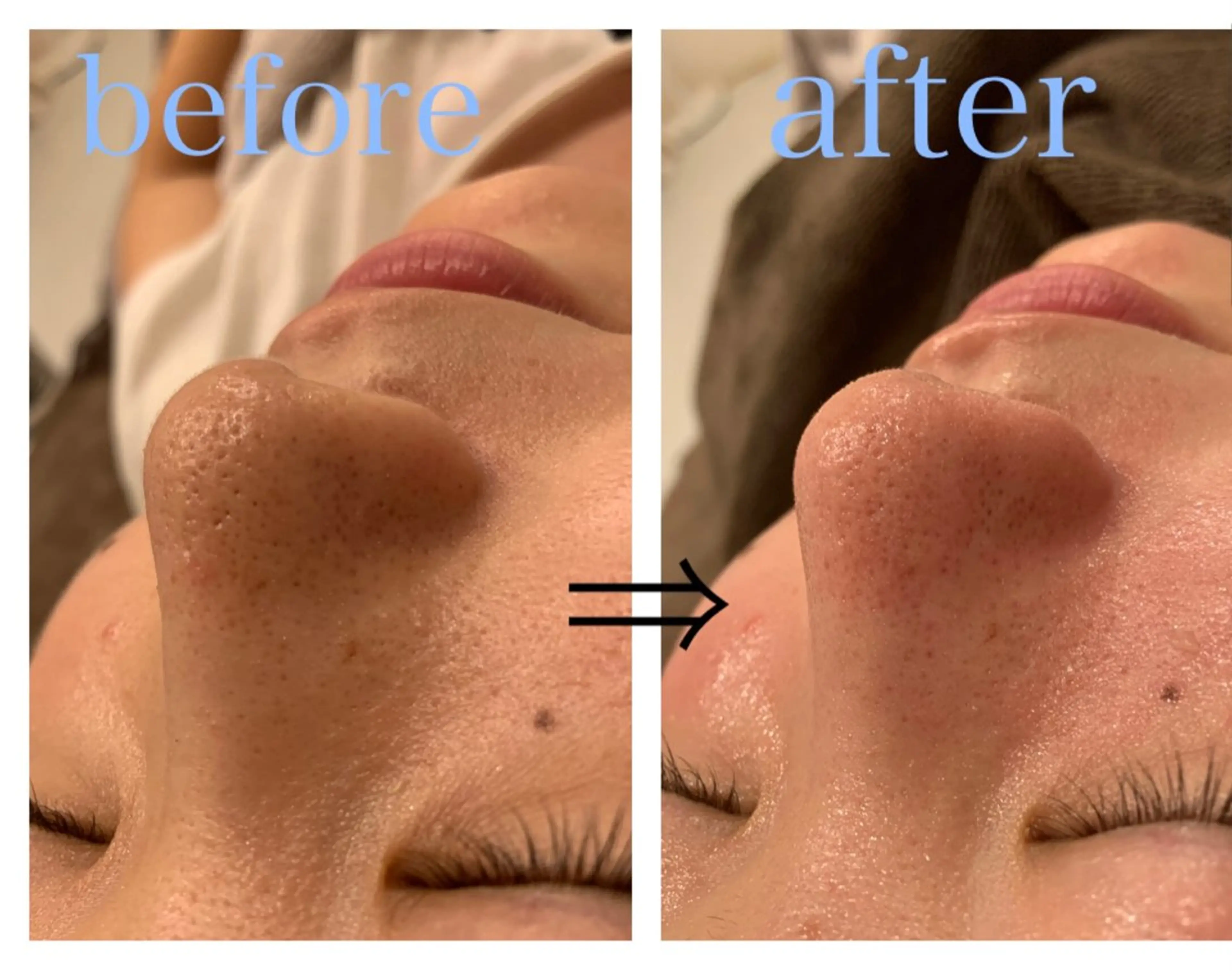 リジュベ所属・Rejuve ﾘｼﾞｭﾍﾞのエステ・リラクイメージ