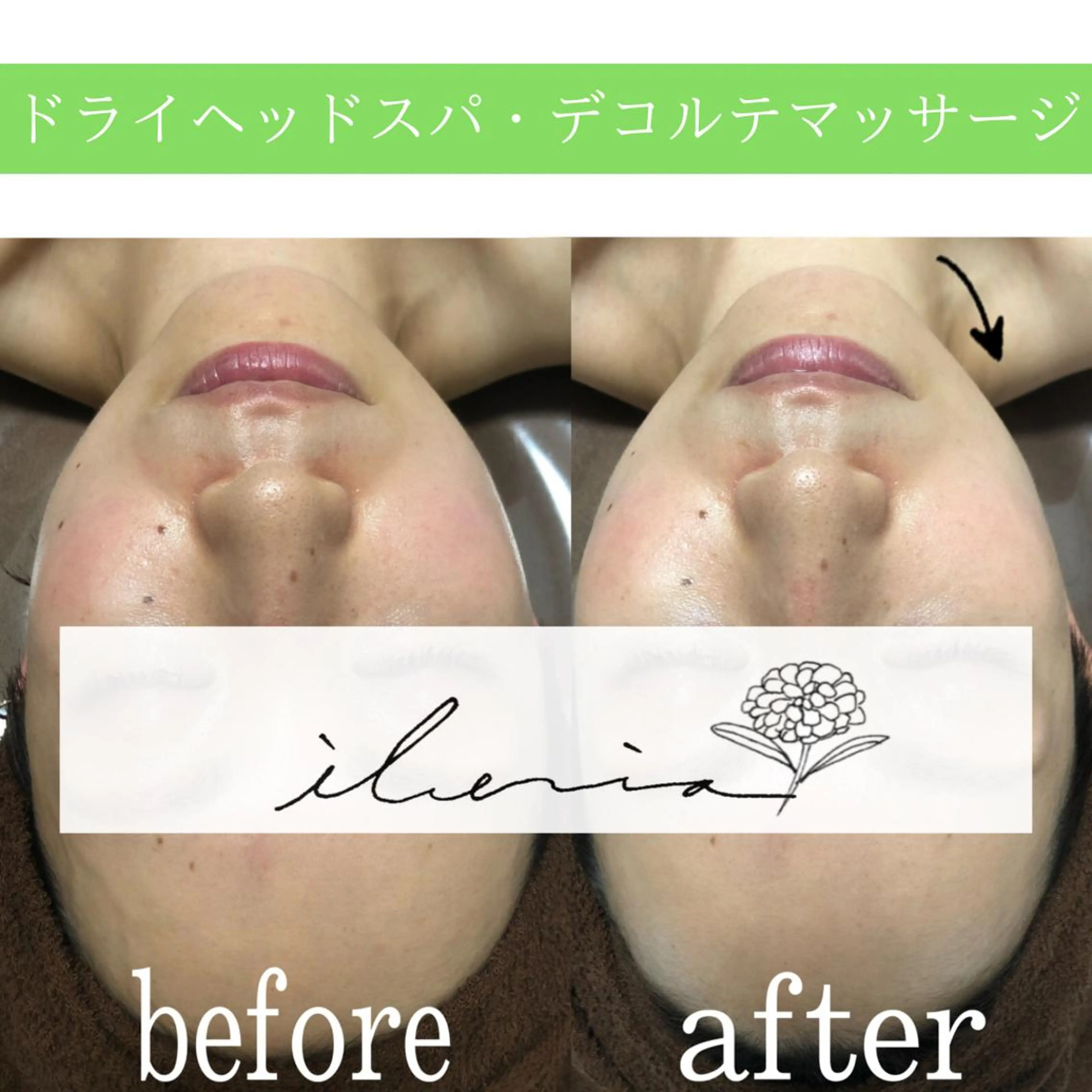 心斎橋痩身ダイエット 韓国.美容鍼.小顔のエステ・リラクイメージ