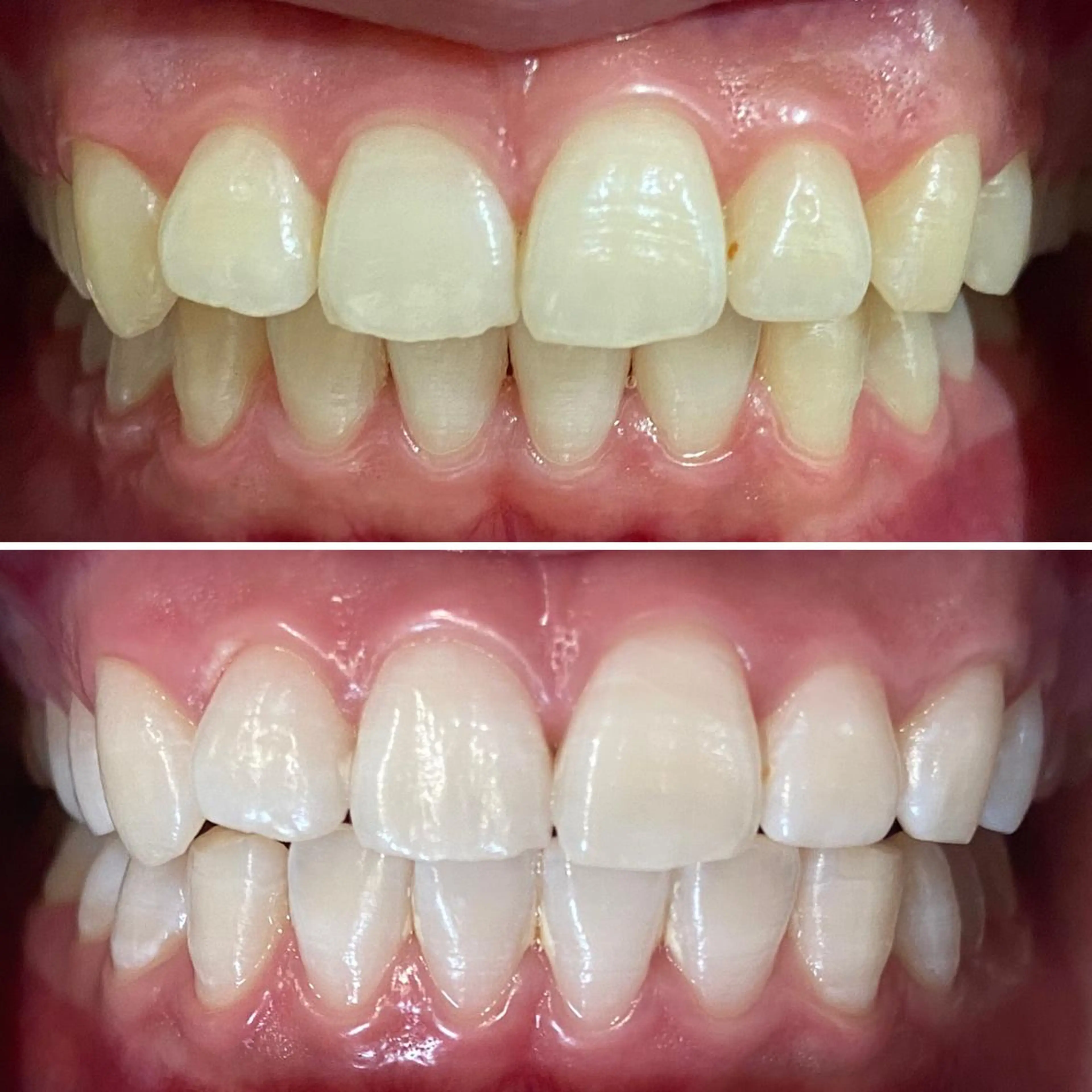 カラー ネイル マツエク・マツパ その他 ホワイトニングサロン CREWのその他イメージ