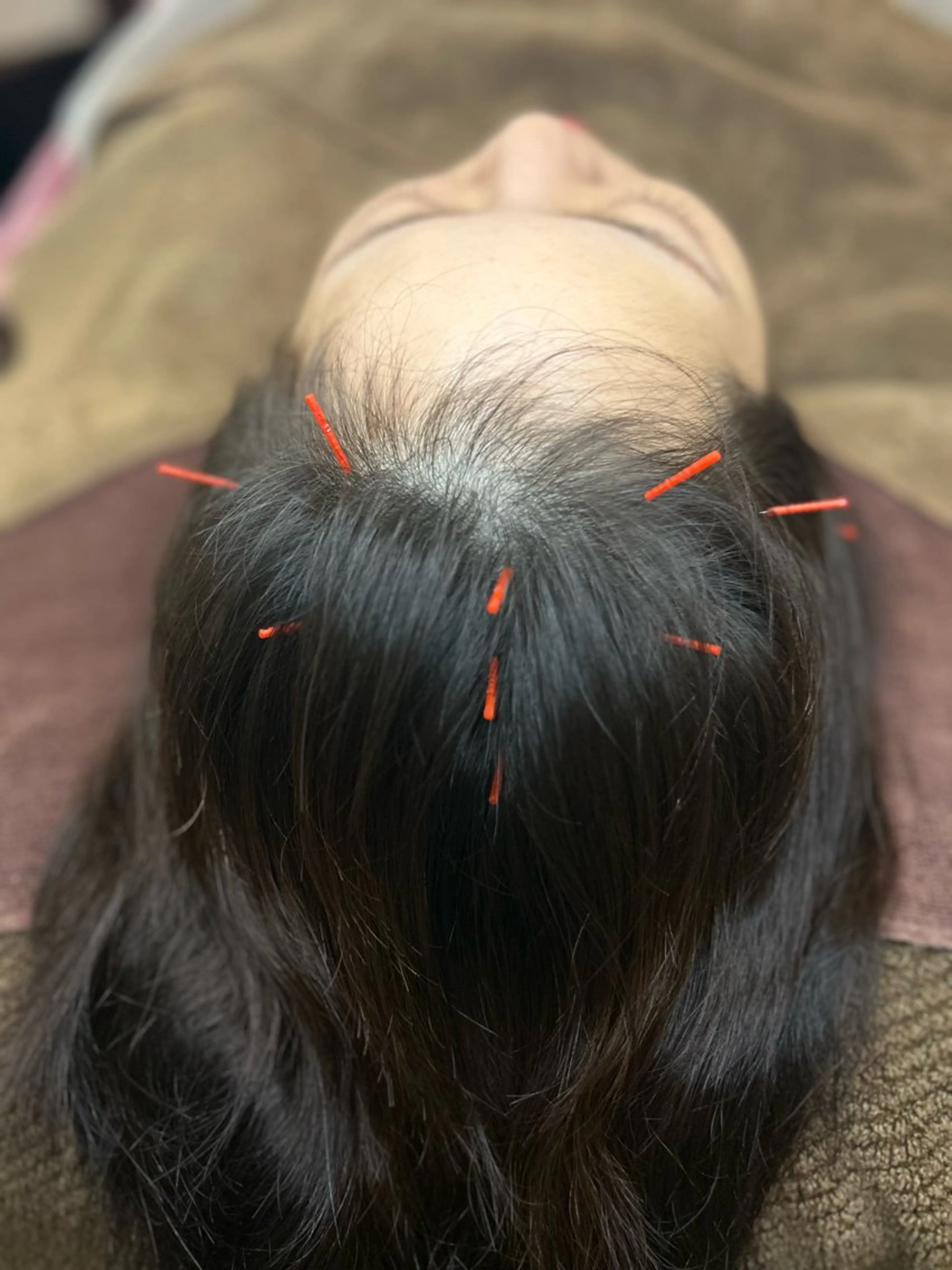 かすがい鍼灸院 Re.heartのエステ・リラクイメージ