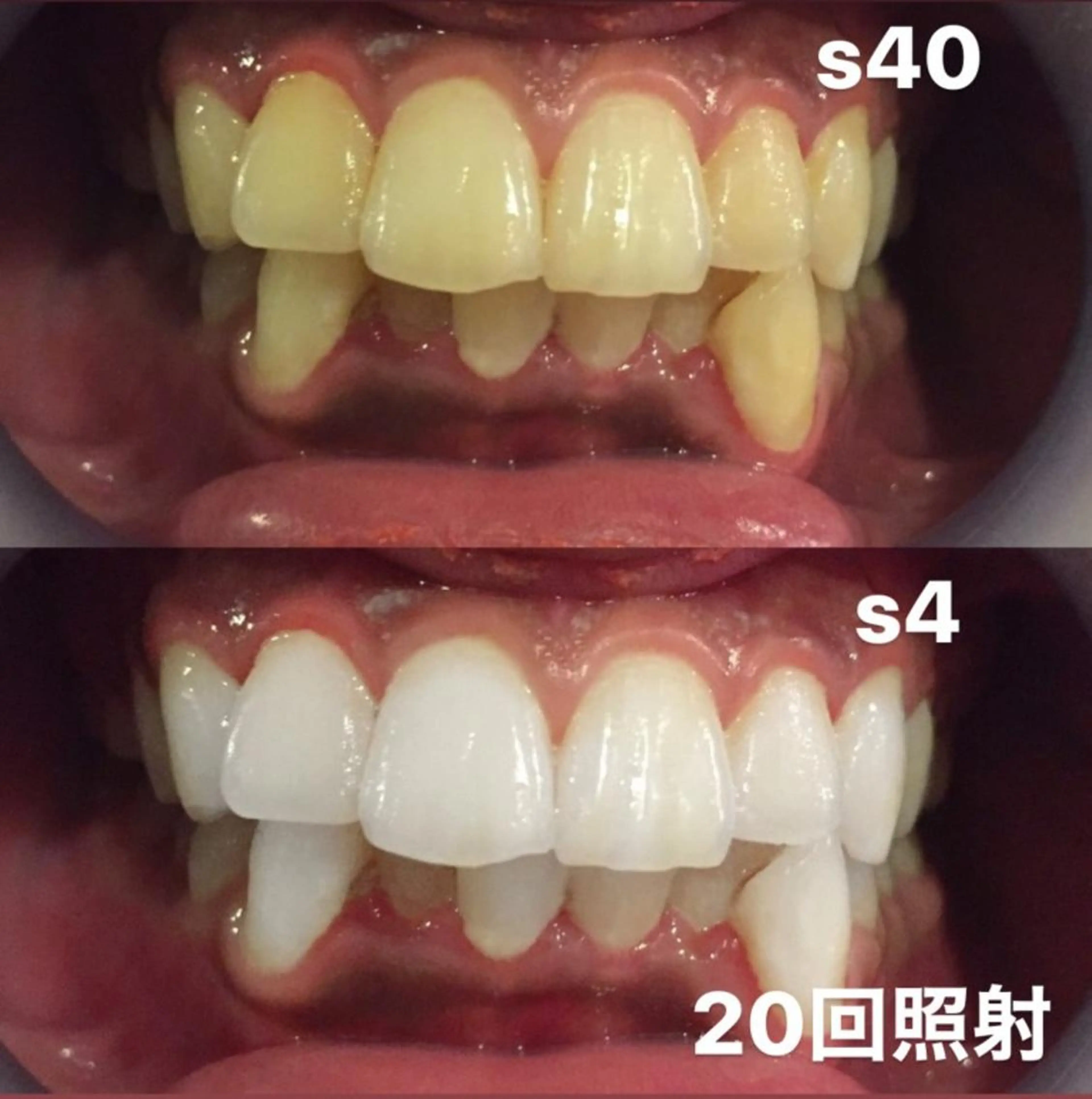 その他 LOVE ホワイトニング表参道のその他イメージ
