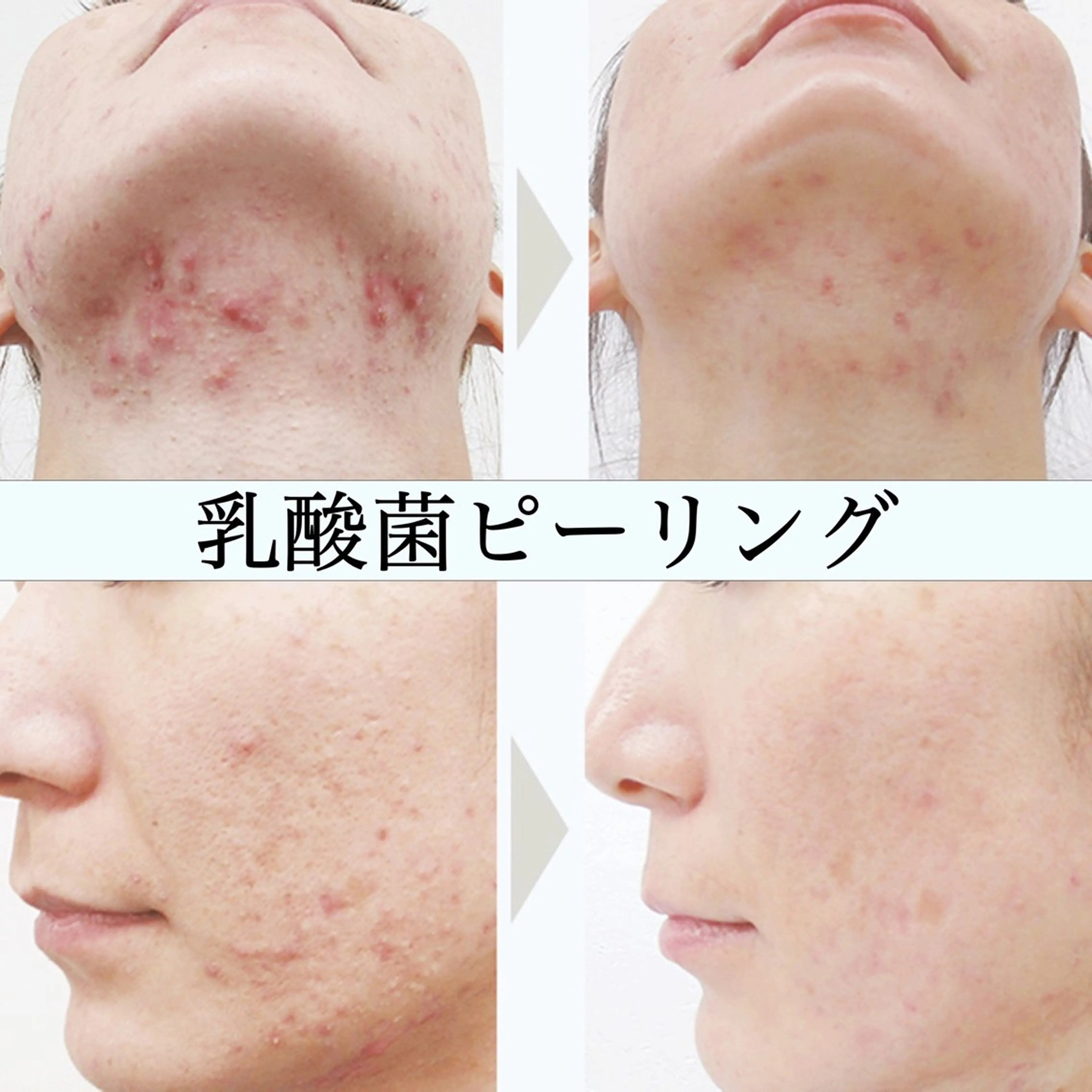 肌管理専門サロン BELLソラのエステ・リラクイメージ