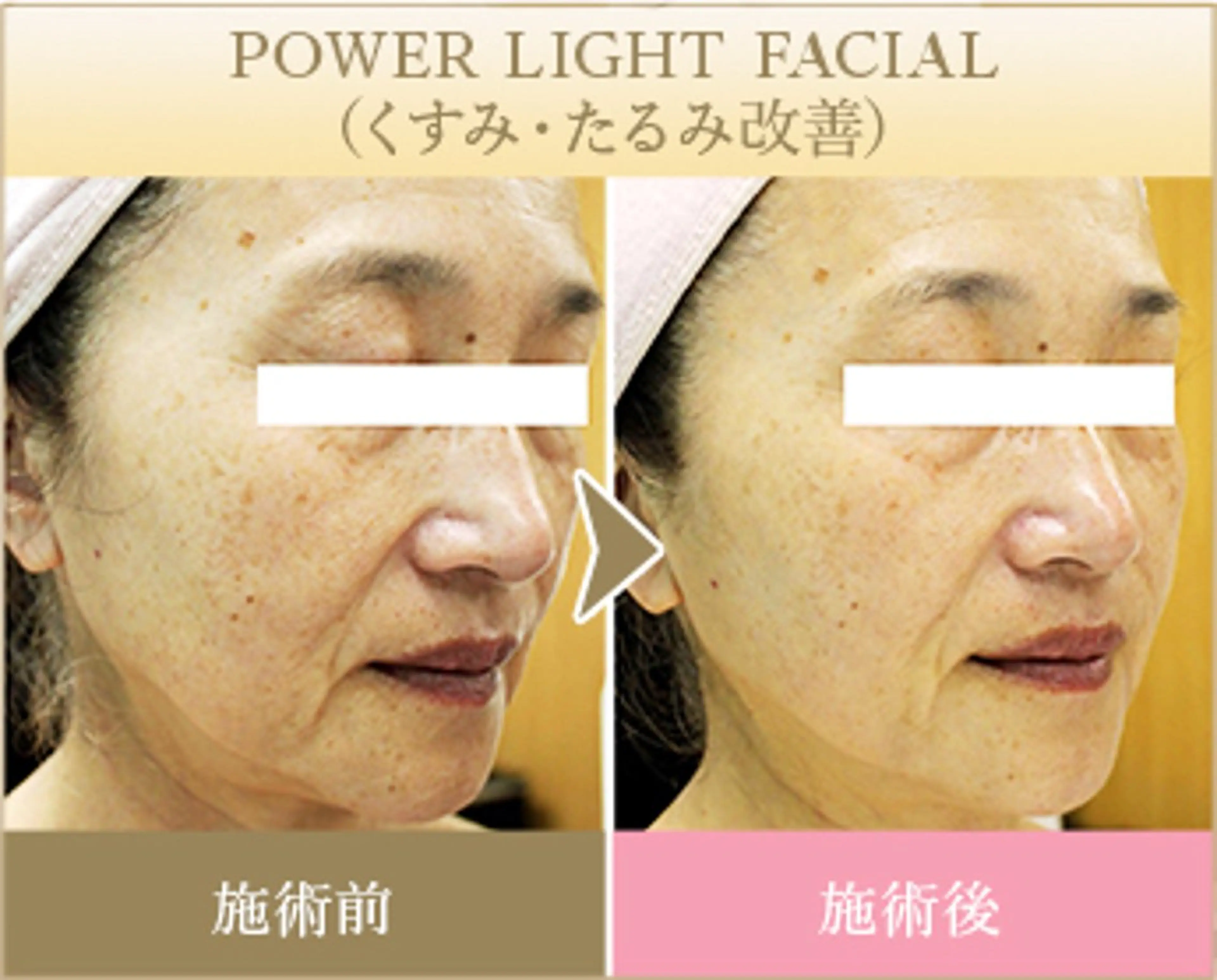 ˚⟡ suwan .˚⟡のエステ・リラクイメージ