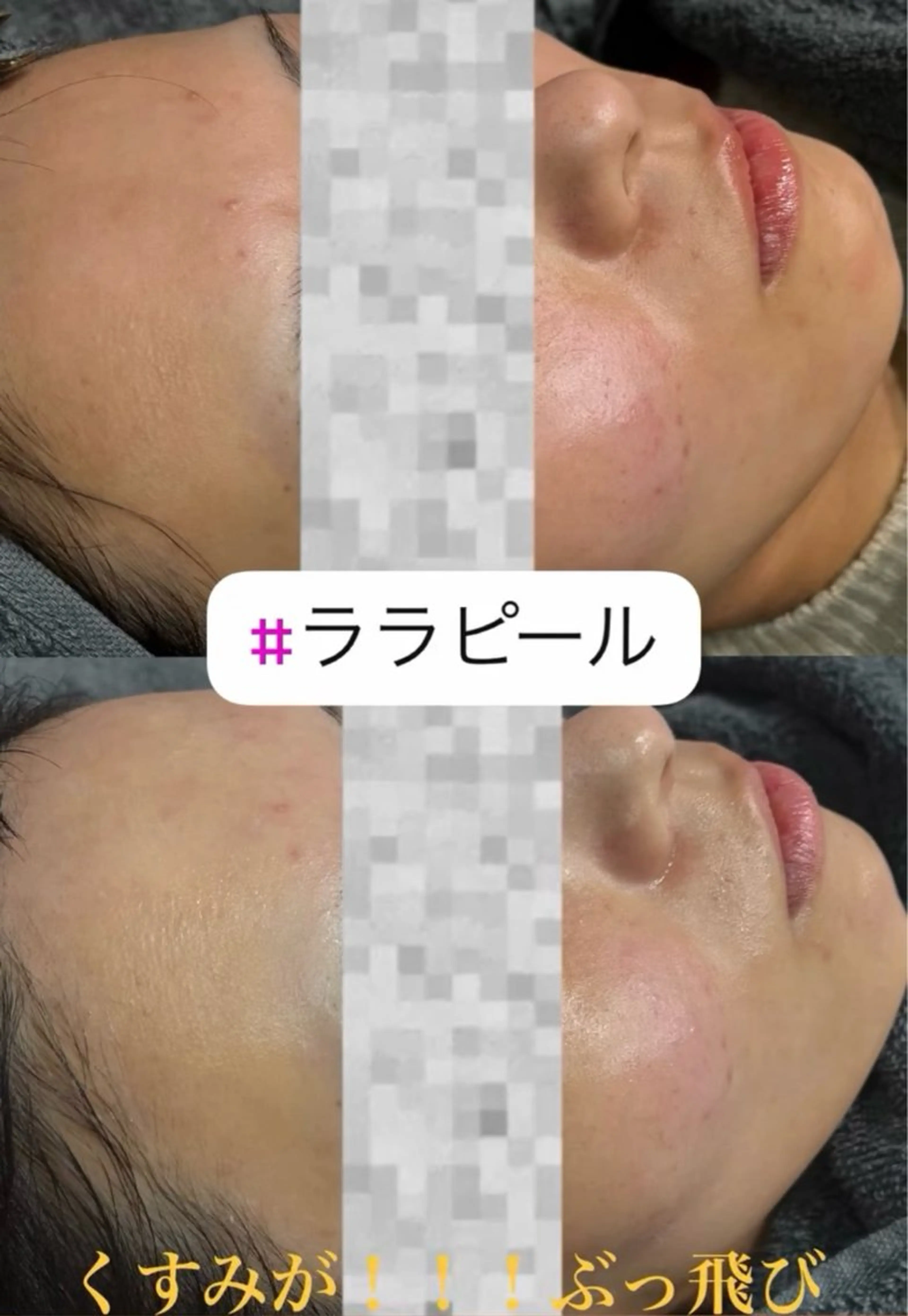 Esthetic ReTweetのエステ・リラクイメージ