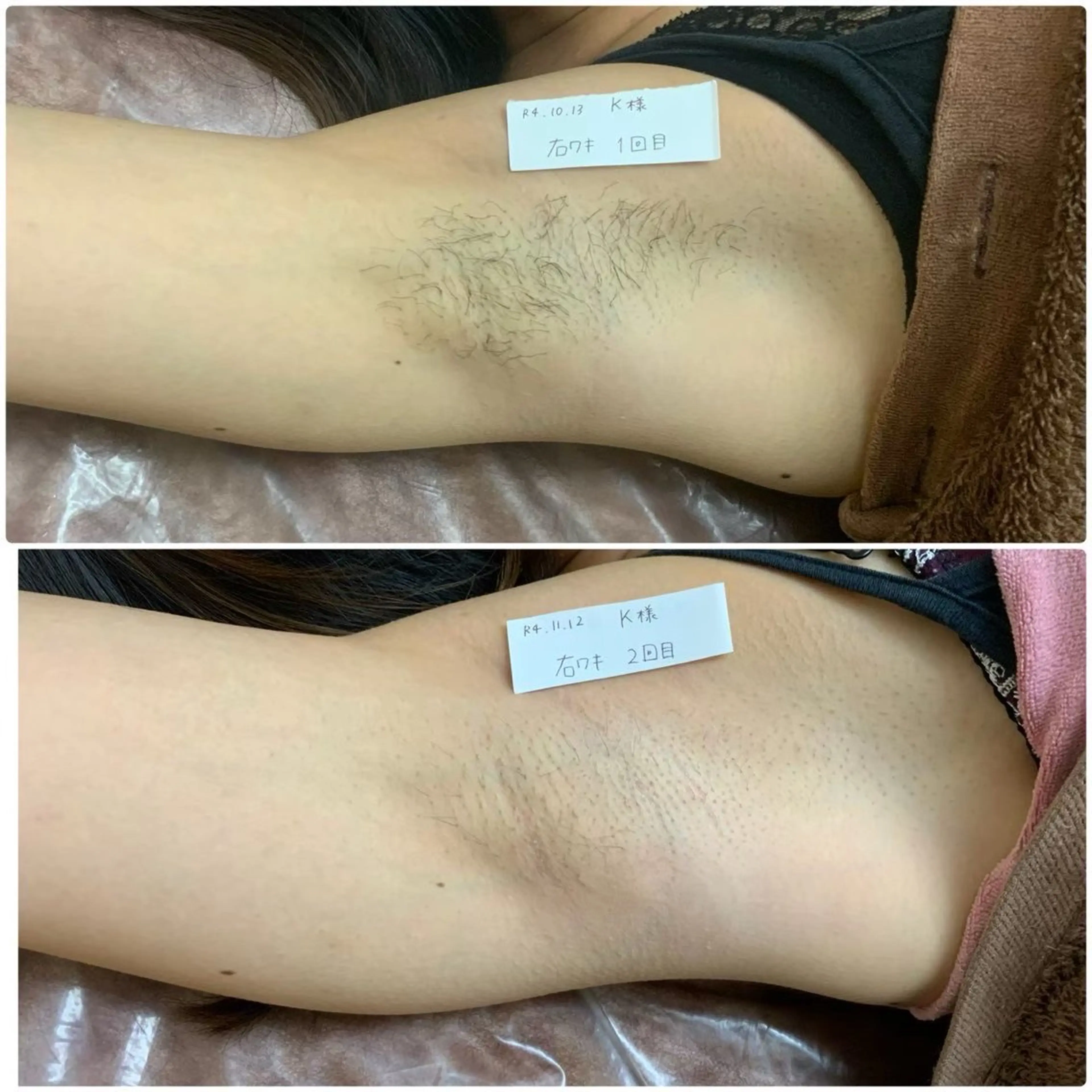 脱毛 Prima栄店所属・Prima 〜プリマ栄店〜のエステ・リラクイメージ