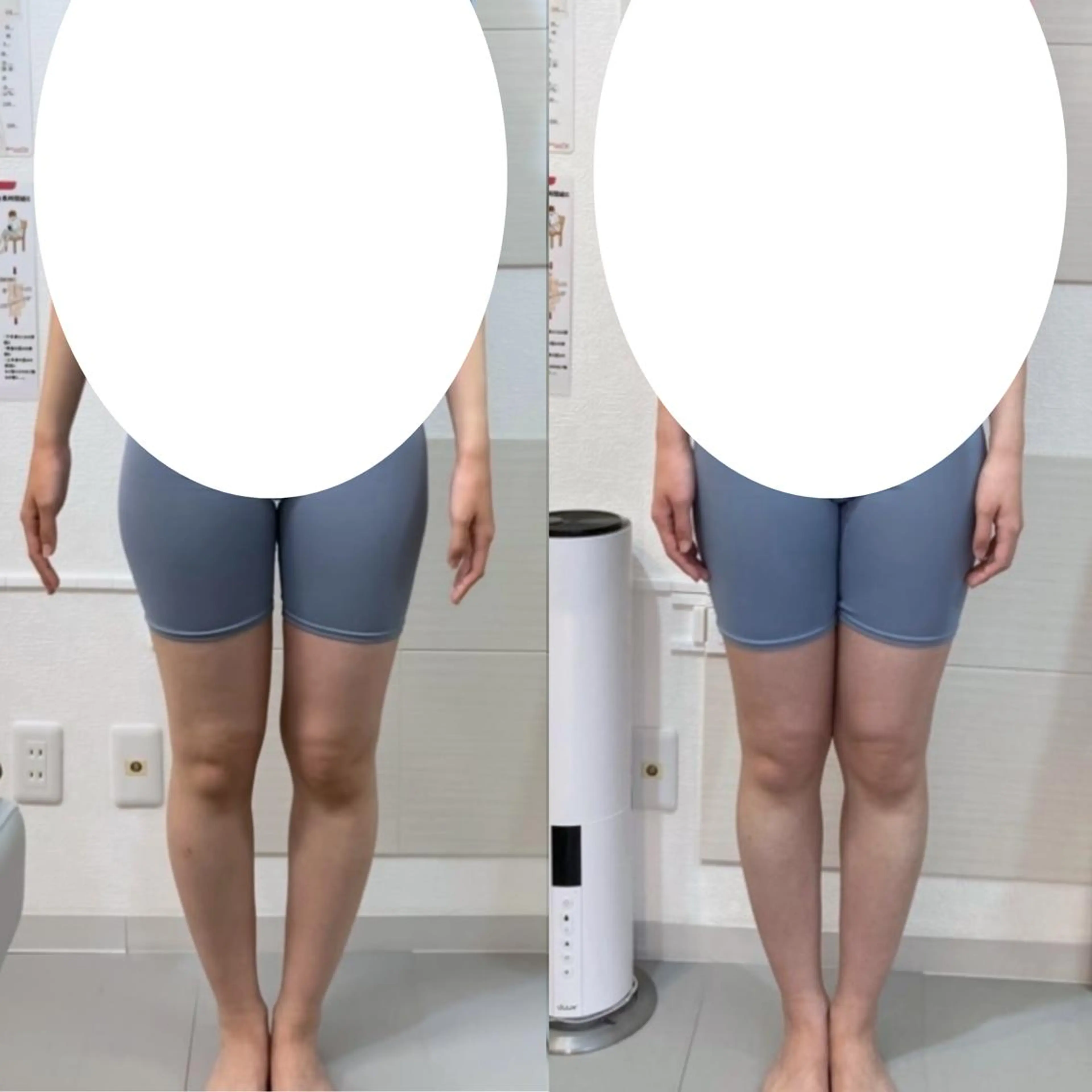 骨格美容整体 bimote.新宿のエステ・リラクイメージ