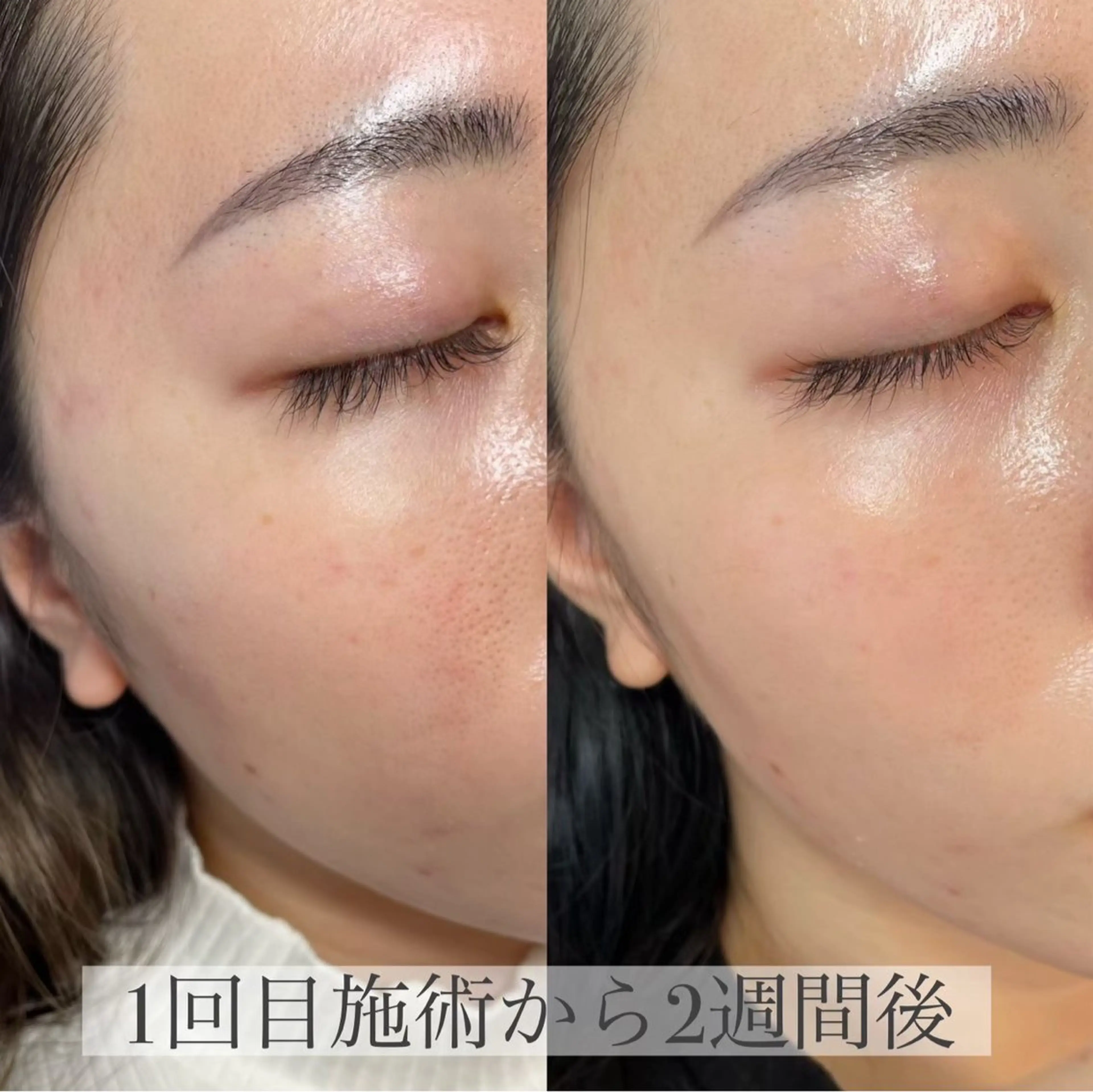 LUVRE龍田 MIKIまつ毛/眉毛の眉毛・アイブロウイメージ