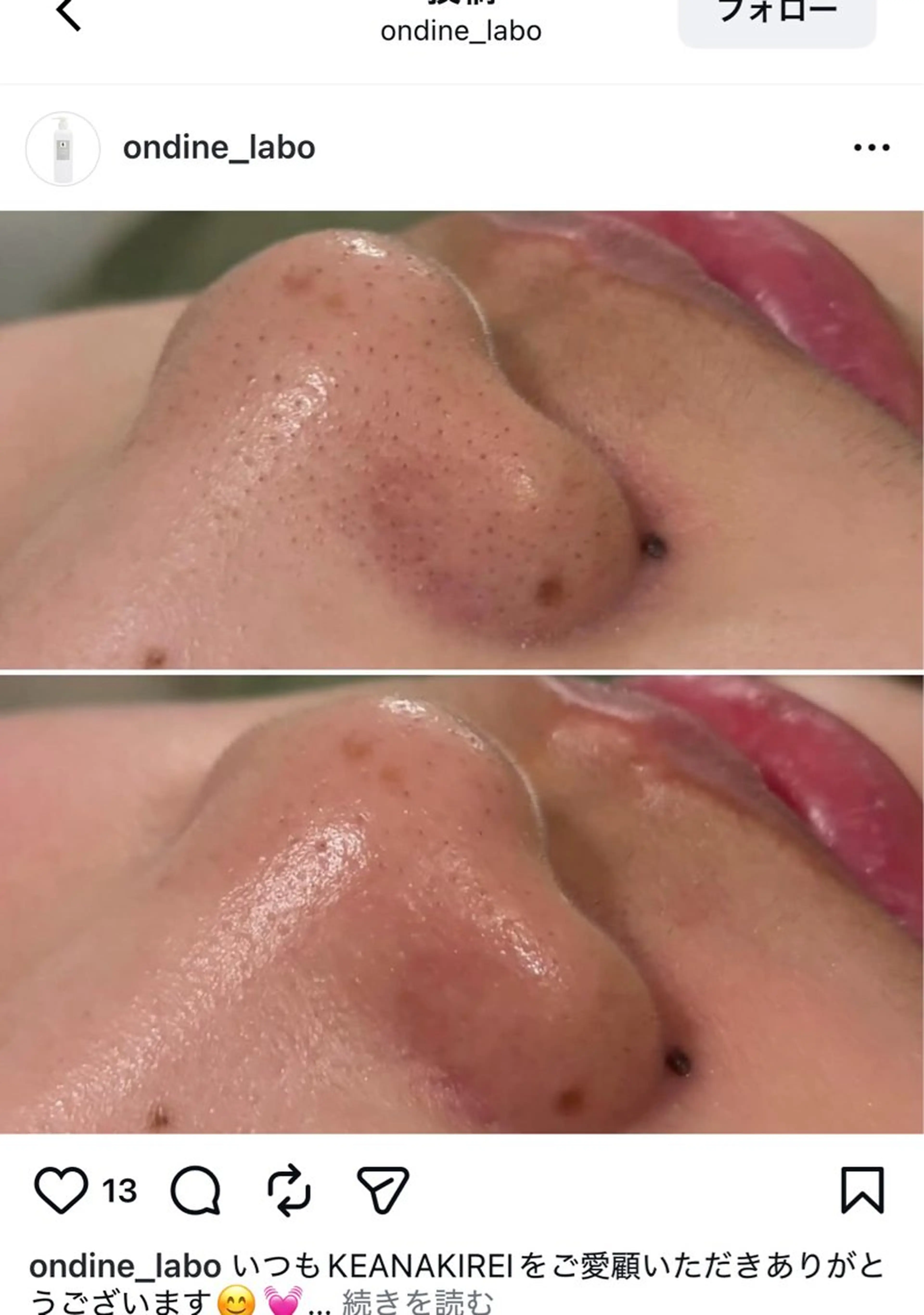 エステ A"-HILU （アーヒル)のエステ・リラクイメージ