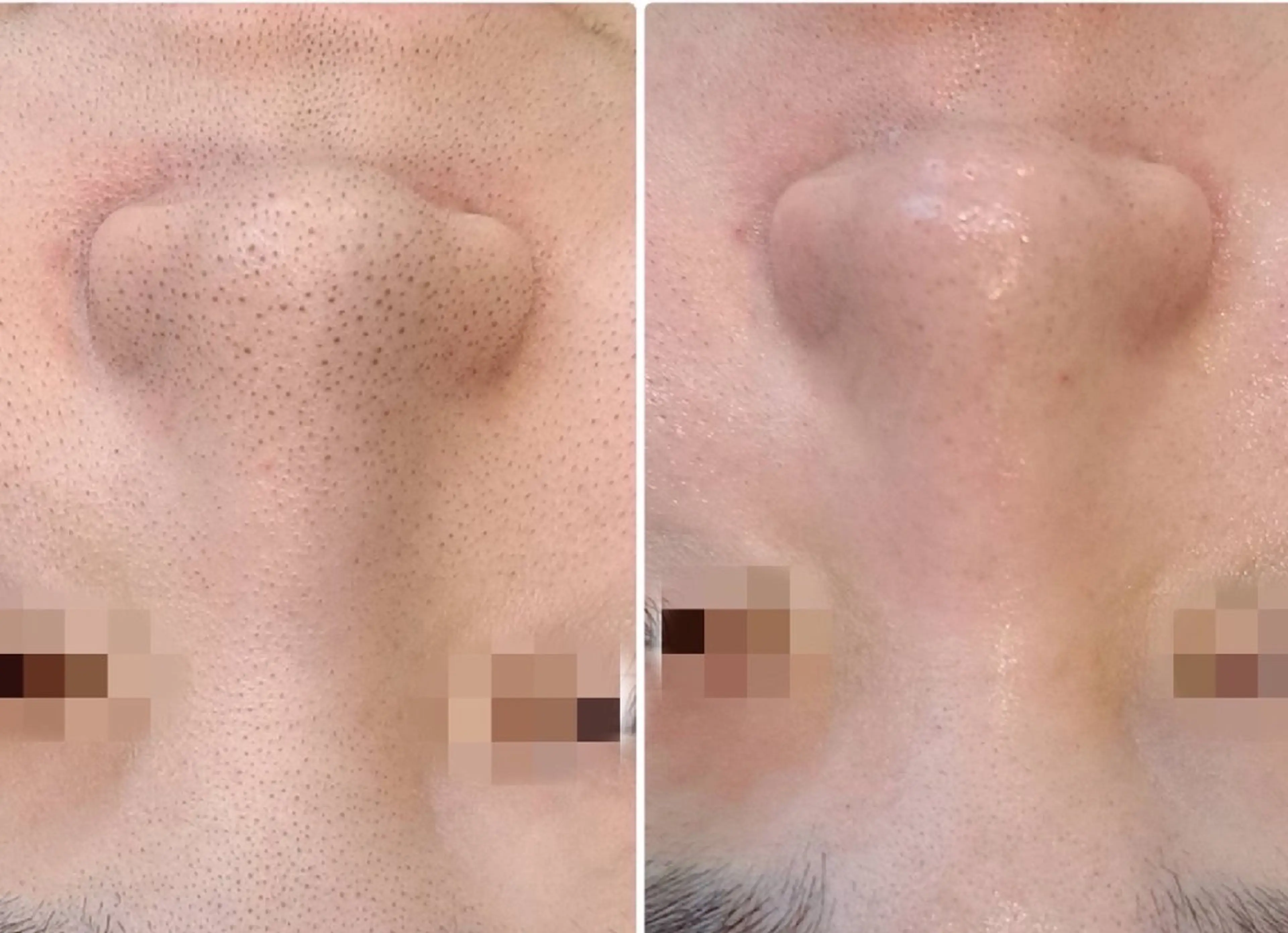 Hisui 種村のエステ・リラクイメージ