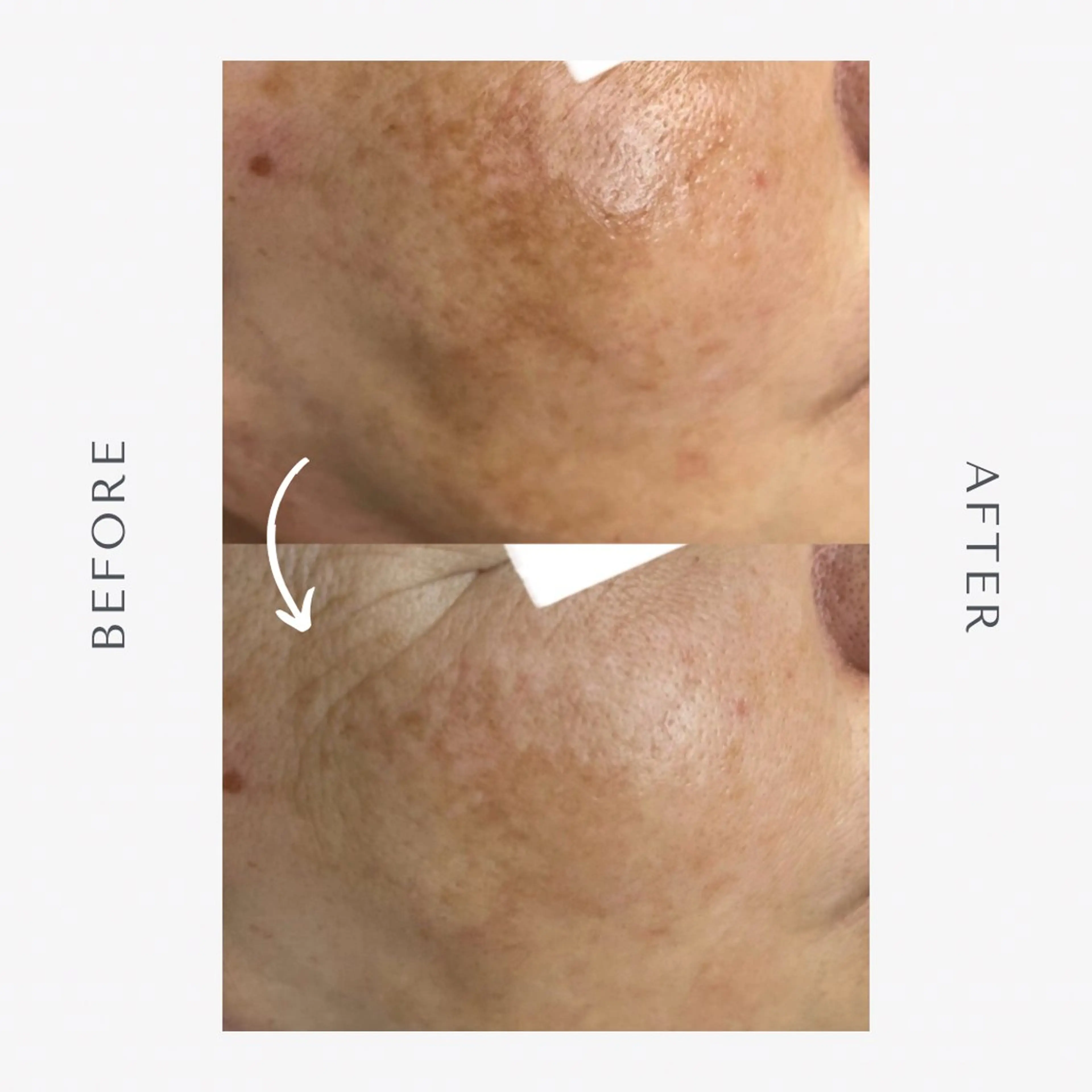 エステ 伊藤 稚菜のエステ・リラクイメージ