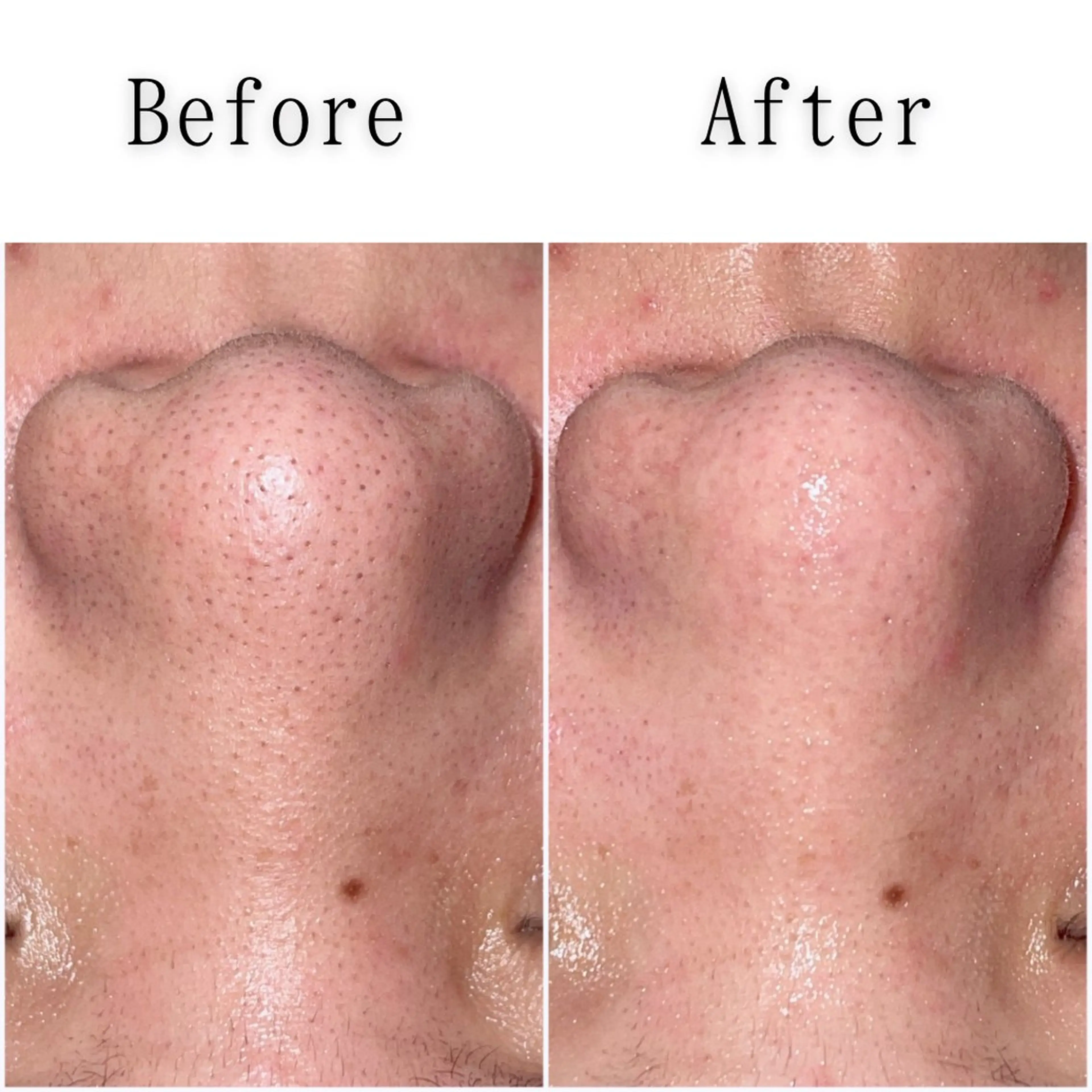 エステ gracia 浦添店のその他イメージ