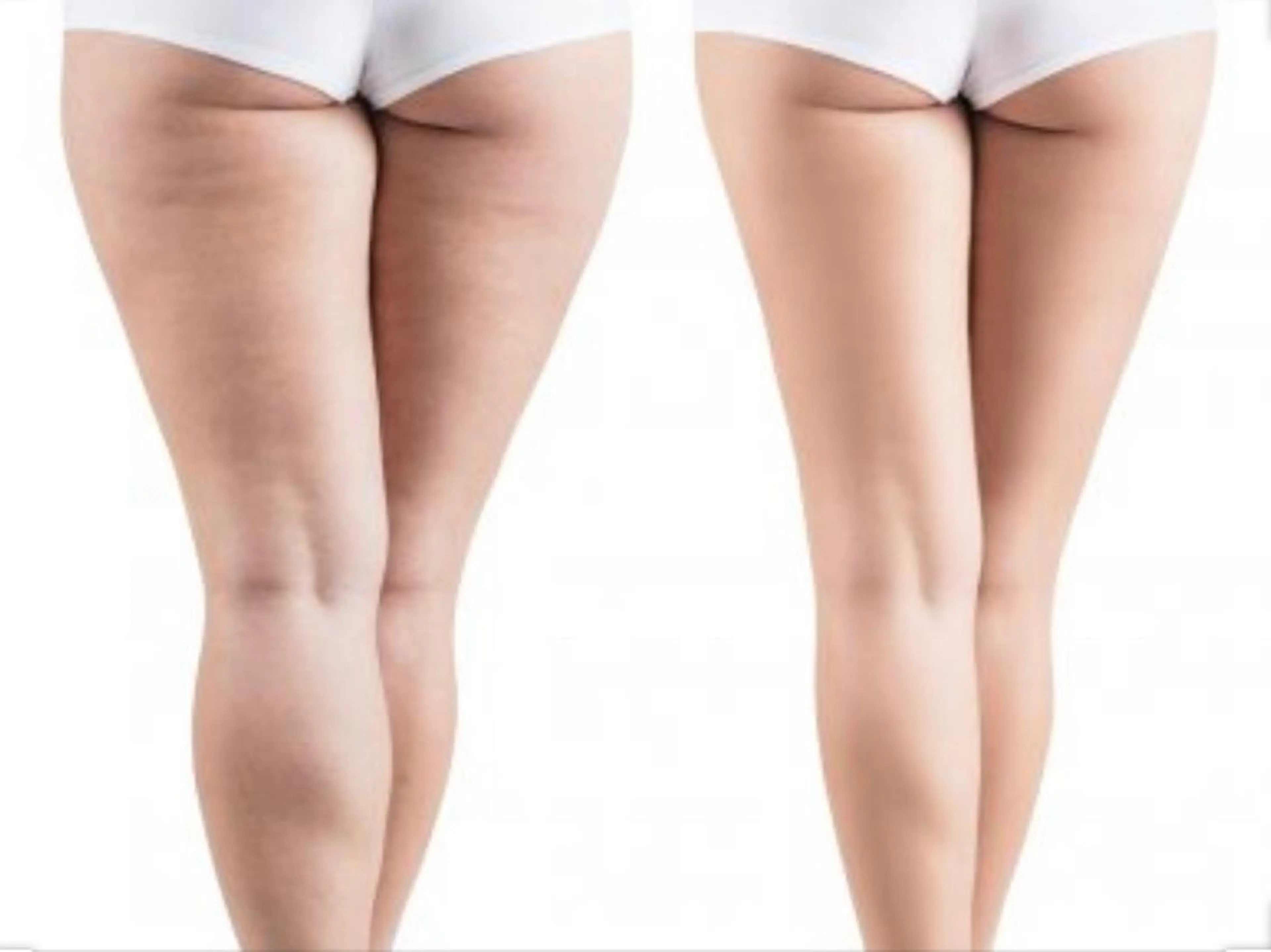 ショート カラー パーマ ヘアアレンジ メンズ キッズ ネイル マツエク・マツパ エステ リラク ‍痩身＆ボディ 結果出し🌟丹野のエステ・リラクイメージ