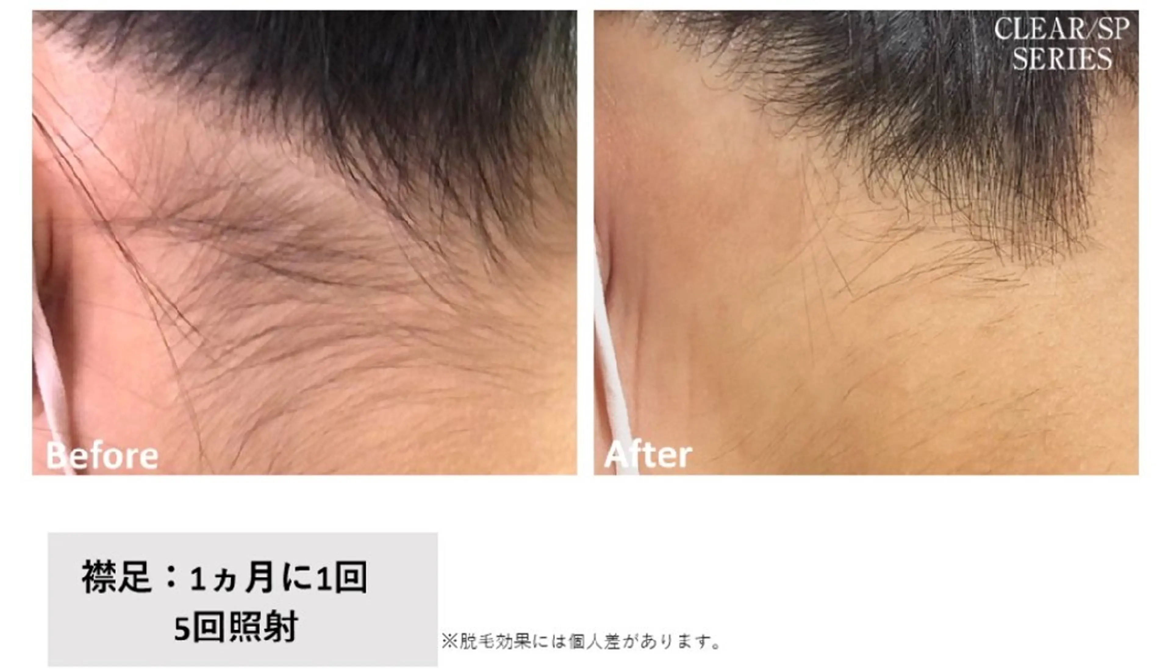 viage 脱毛&フェイシャル店のエステ・リラクイメージ