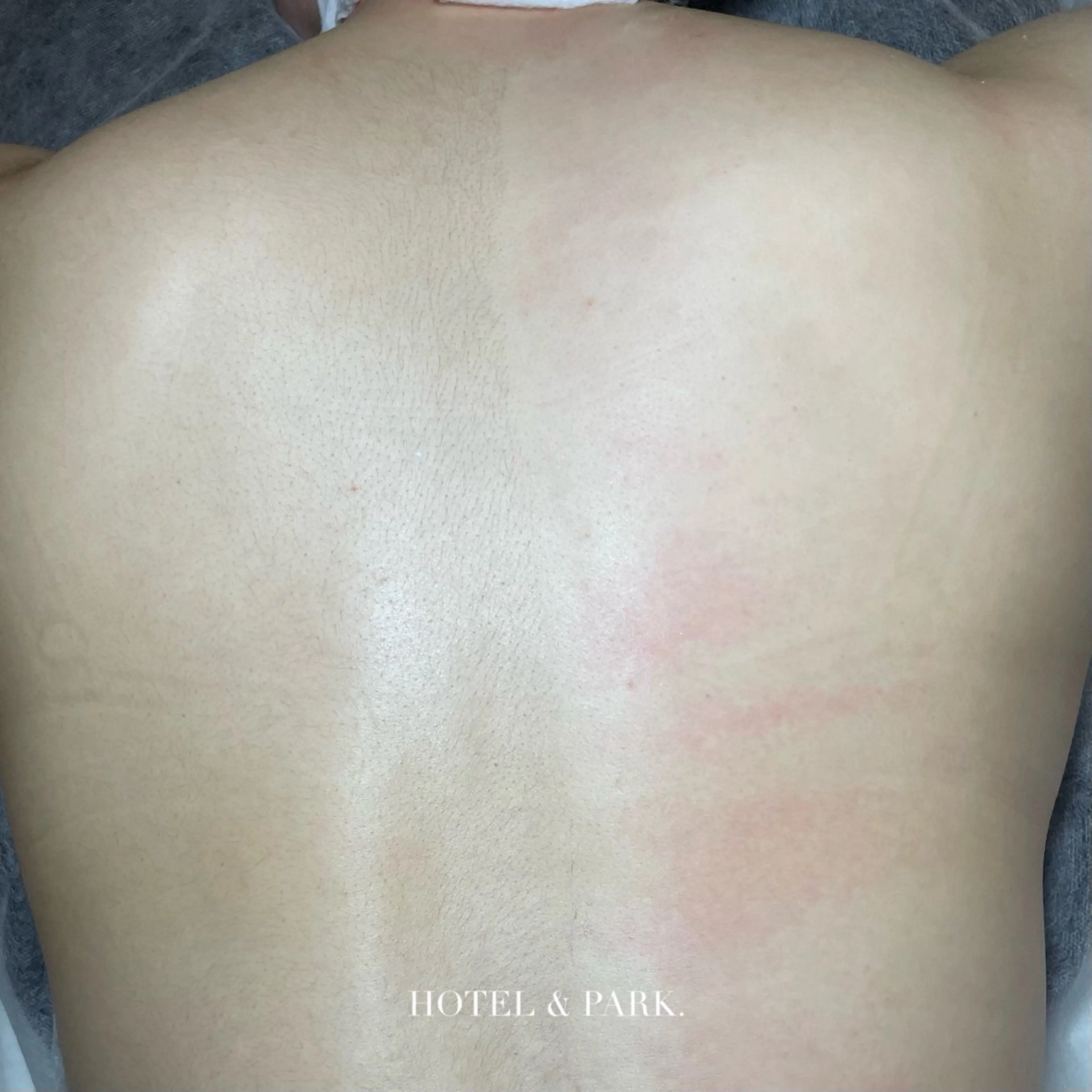 HOTEL&PARK . ワックス脱毛のエステ・リラクイメージ