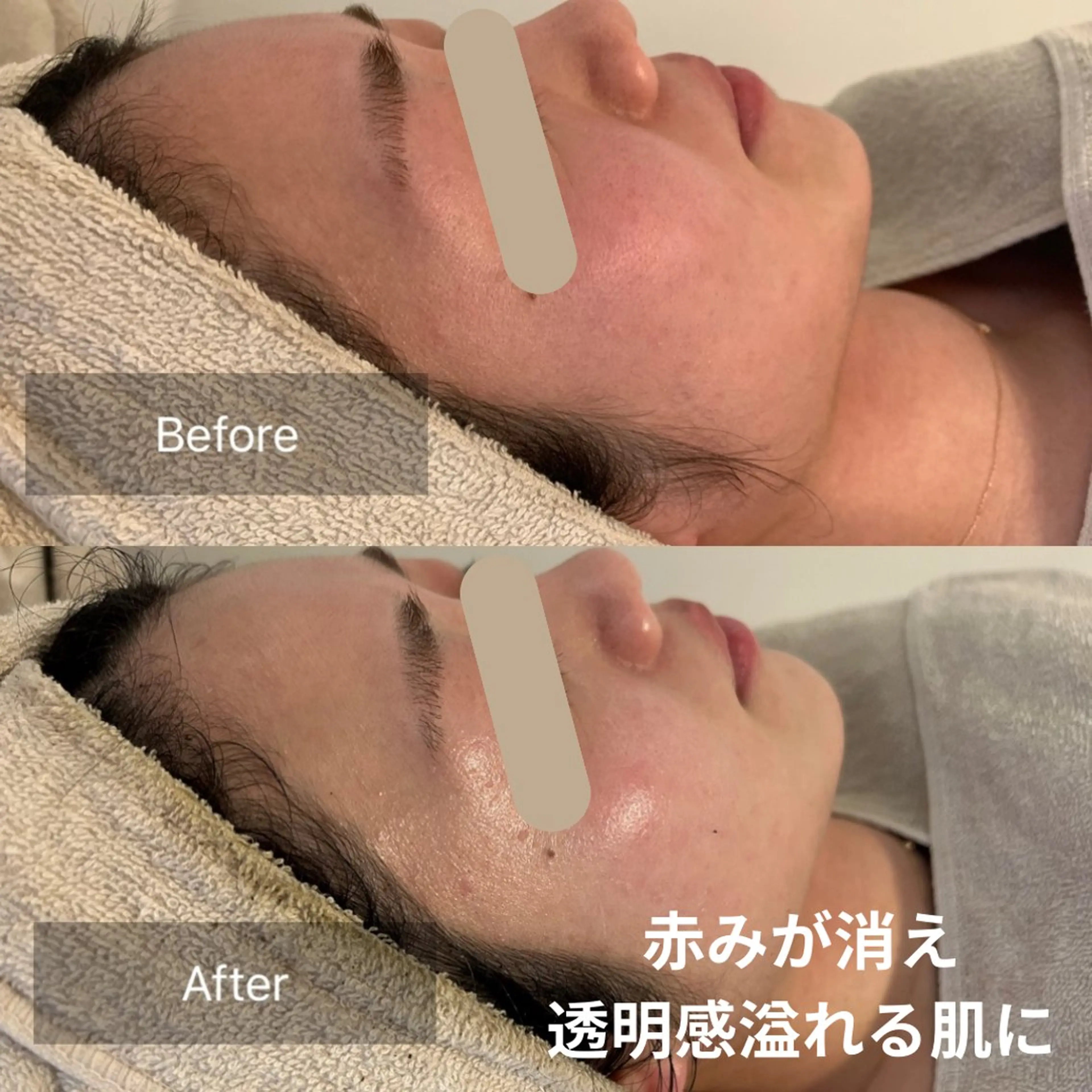 エステ 松山 舞衣のエステ・リラクイメージ