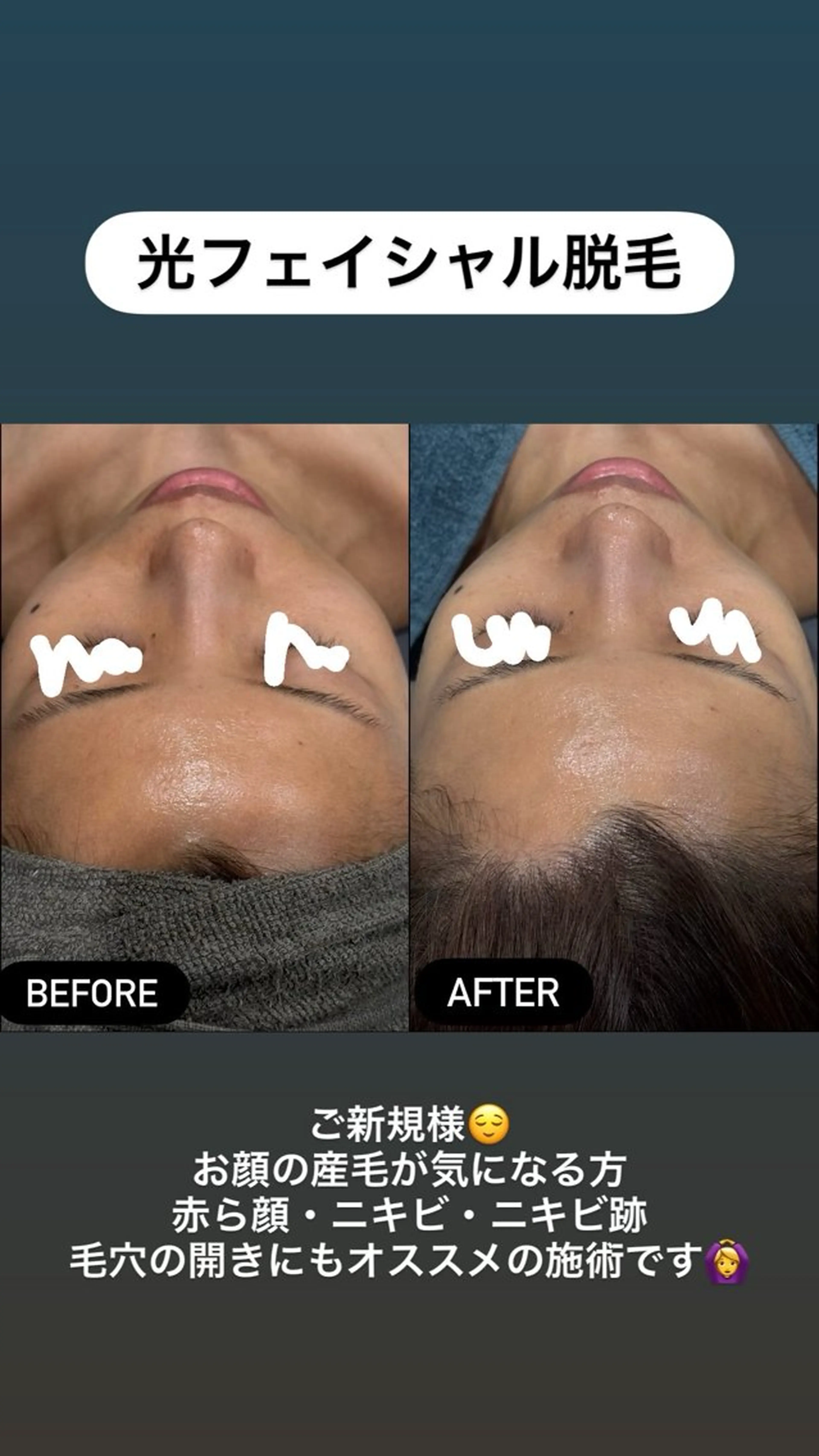 エステ LiZA エステティックサロンのエステ・リラクイメージ