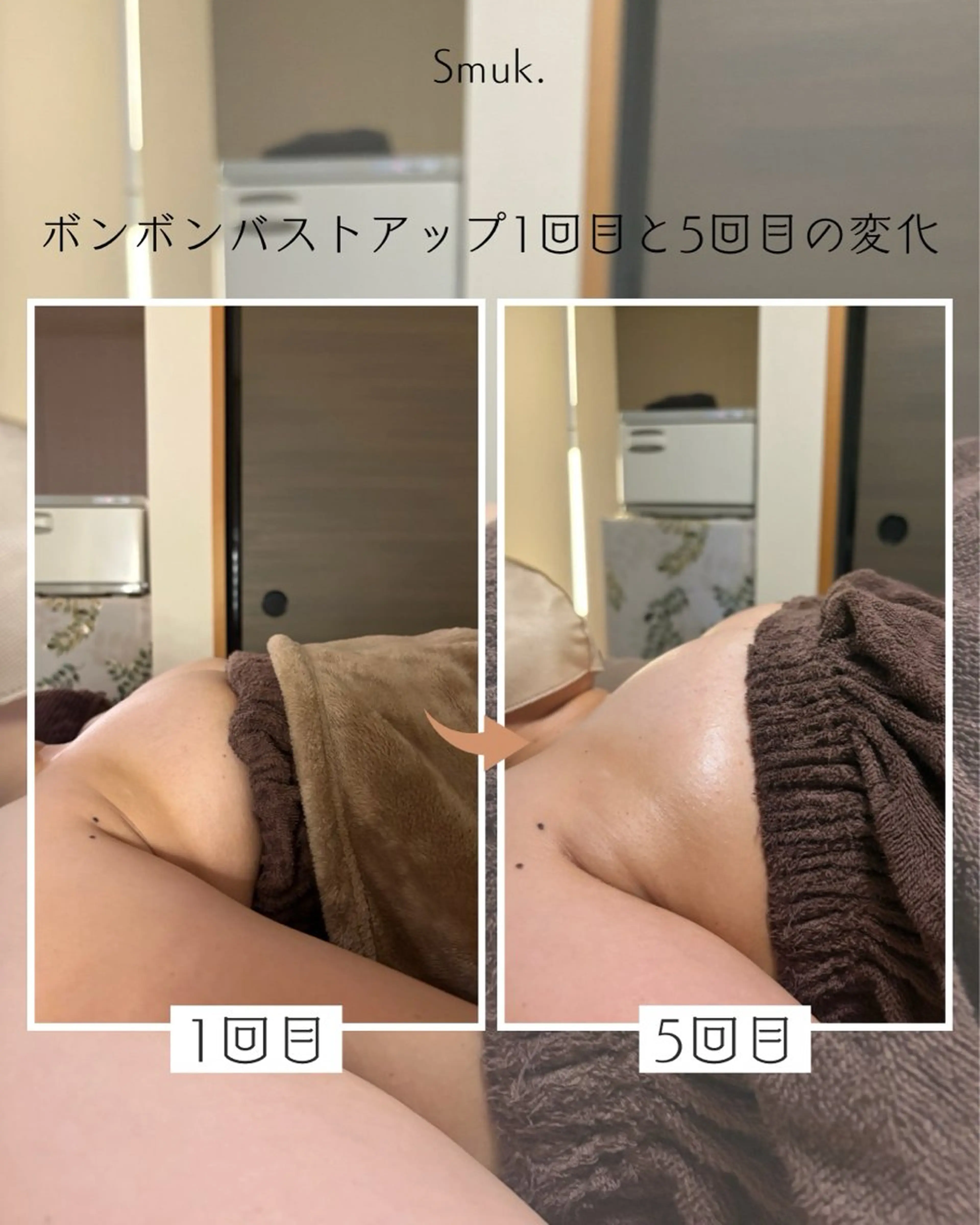 バストアップ(バストアップ)の写真