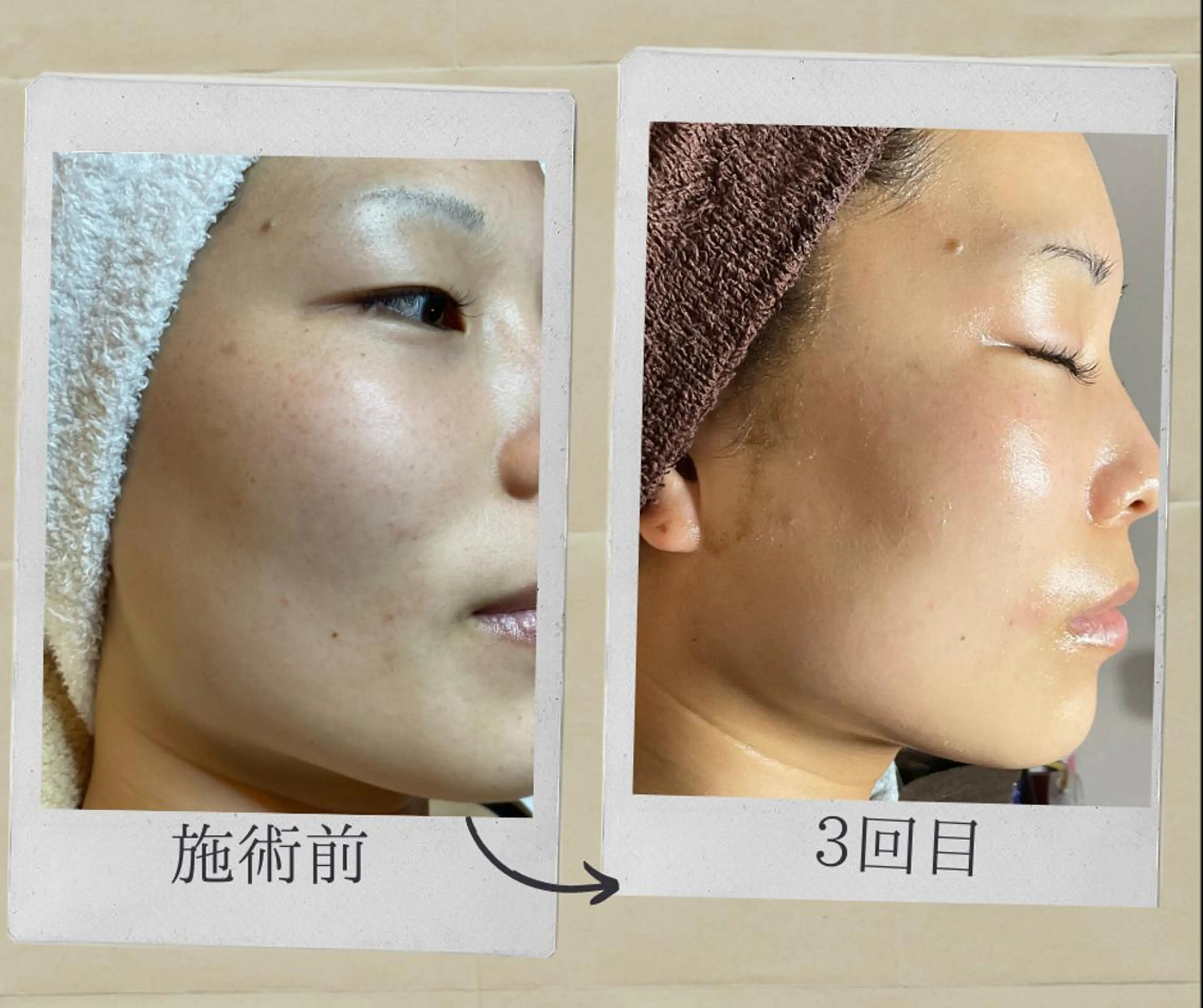 代表 MOMOのエステ・リラクイメージ