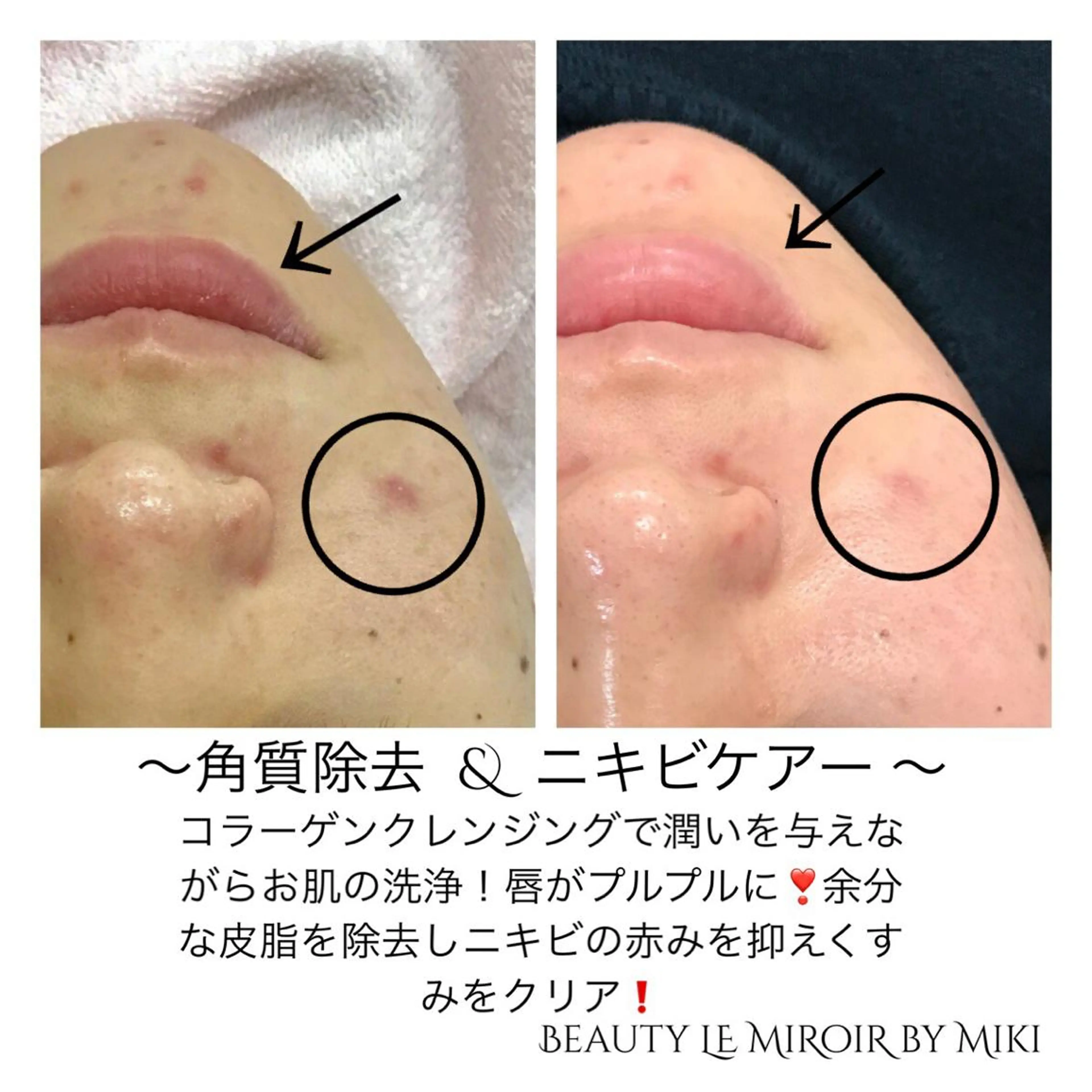 ビューティー ミロワールのエステ・リラクイメージ