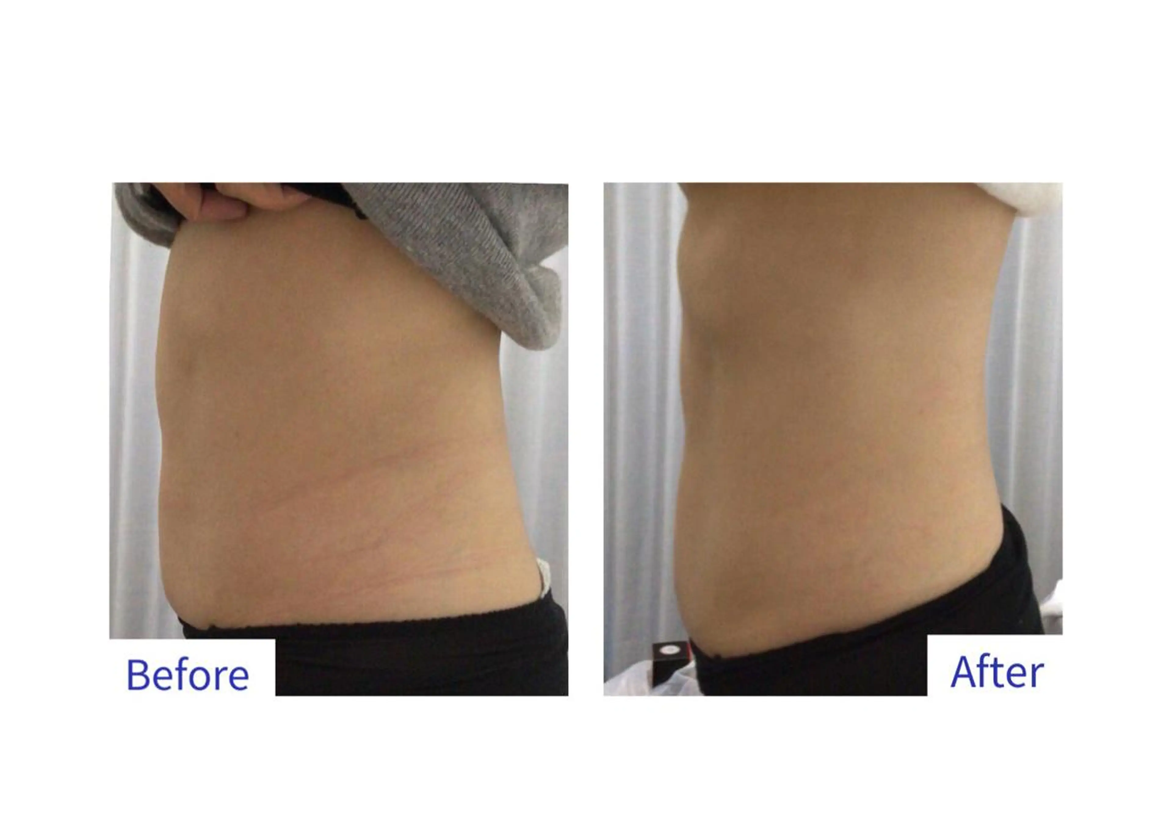 子宮矯正/腸揉み/ シュガーリング脱毛のエステ・リラクイメージ