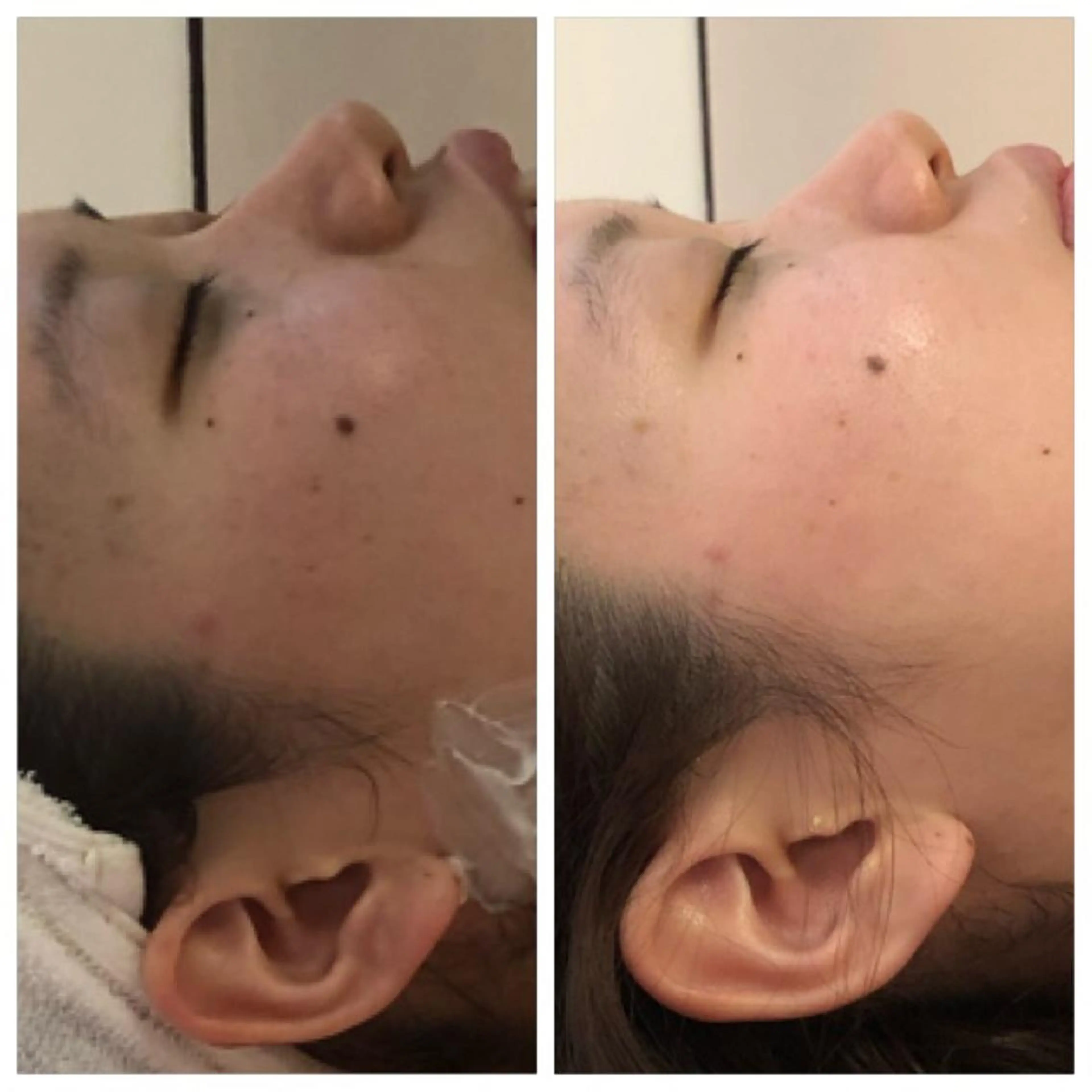 エステ メナードグレスハート 木村直子のエステ・リラクイメージ