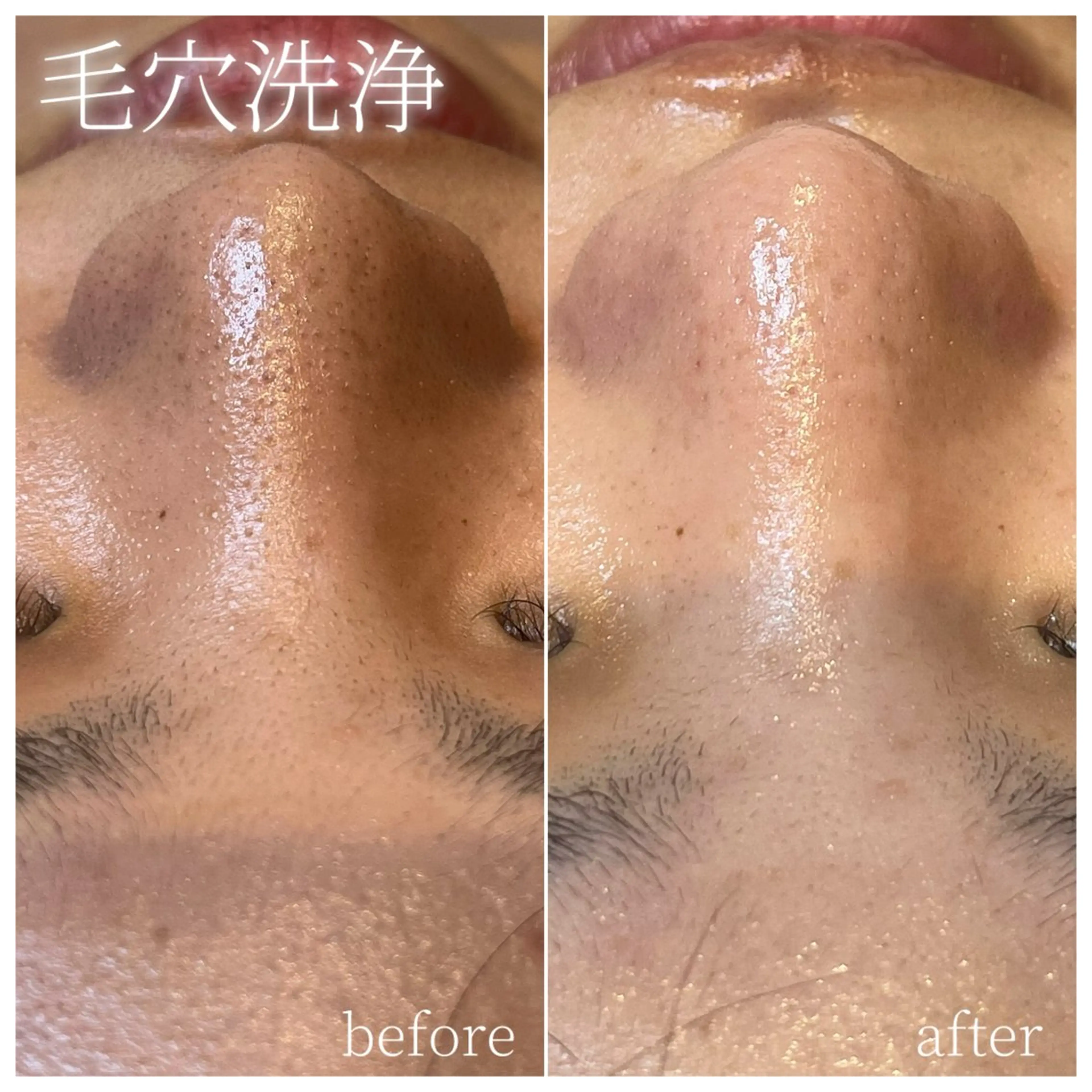 エステ La Dusa 韓国肌管理/小波のエステ・リラクイメージ